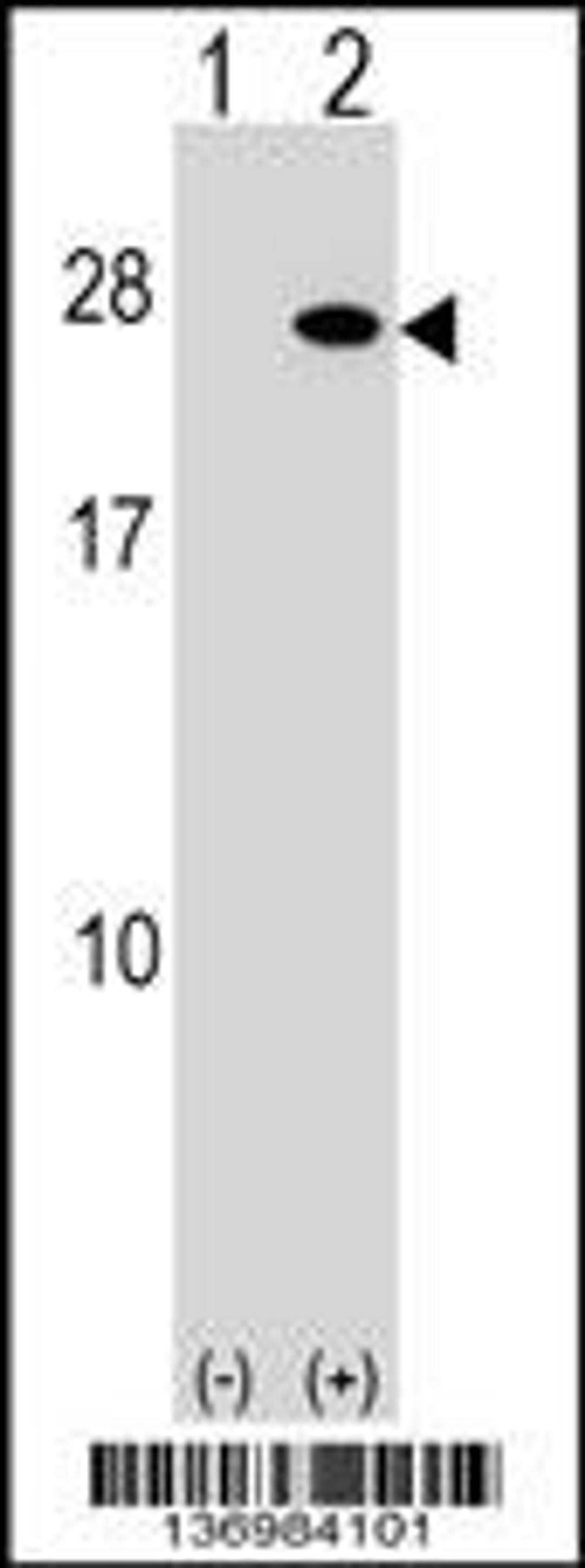 Western blot analysis of FGF19 using rabbit polyclonal FGF19 Antibody using 293 cell lysates (2 ug/lane) either nontransfected (Lane 1) or transiently transfected (Lane 2) with the FGF19 gene.