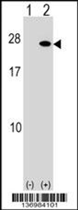 Western blot analysis of FGF19 using rabbit polyclonal FGF19 Antibody using 293 cell lysates (2 ug/lane) either nontransfected (Lane 1) or transiently transfected (Lane 2) with the FGF19 gene.