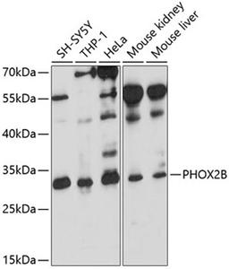 Western blot - PHOX2B antibody (A9685)