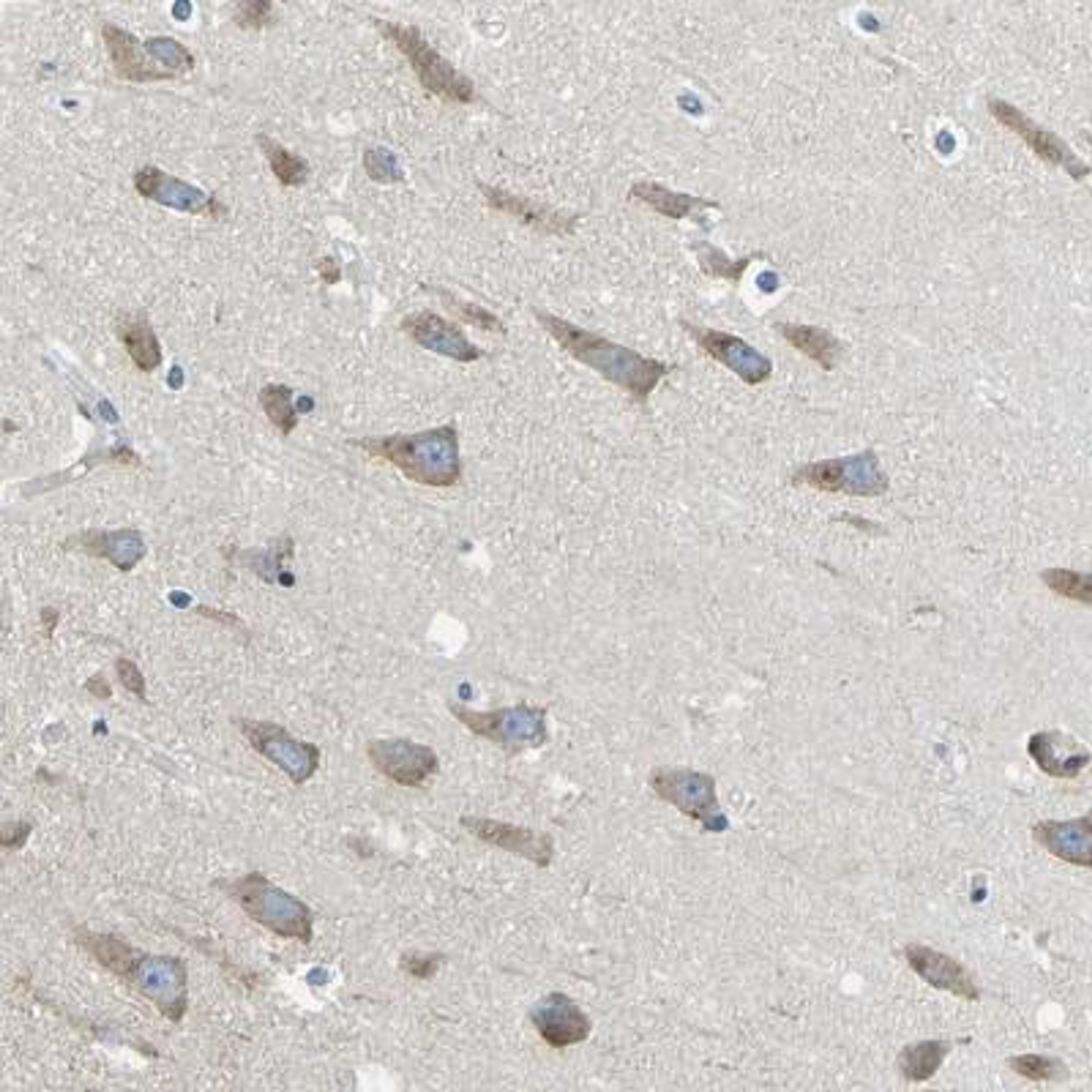 Immunohistochemistry: LIAS Antibody [NBP1-82845] - Staining of human hippocampus shows cytoplasmic positivity in neuronal cells.