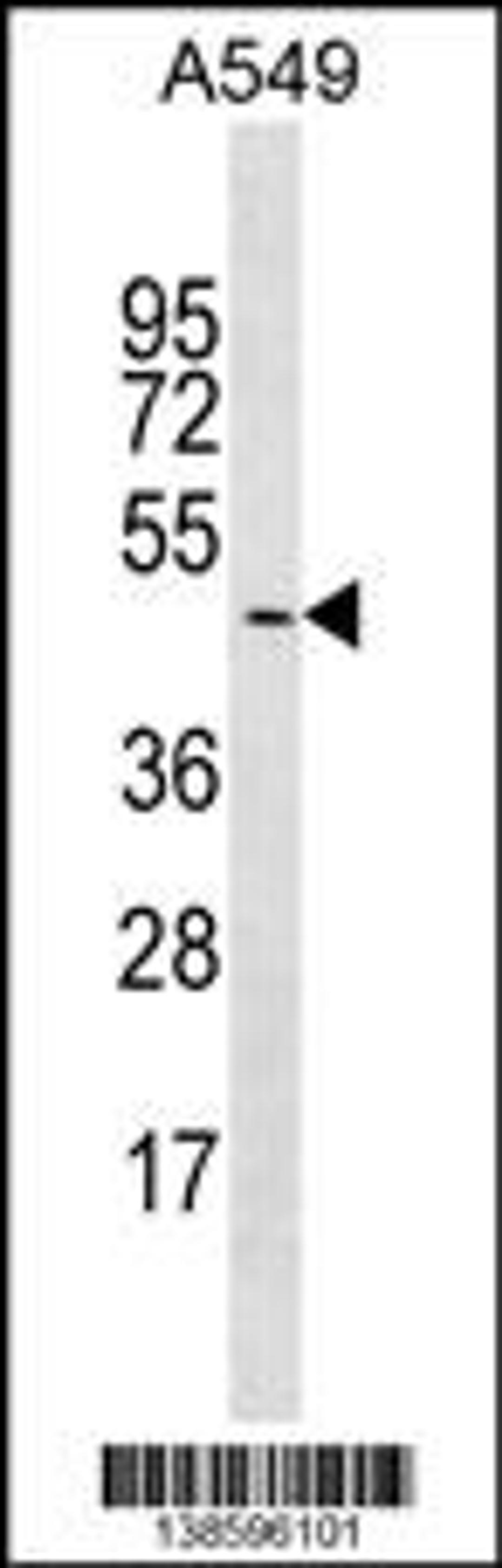 Western blot analysis in A549 cell line lysates (35ug/lane).