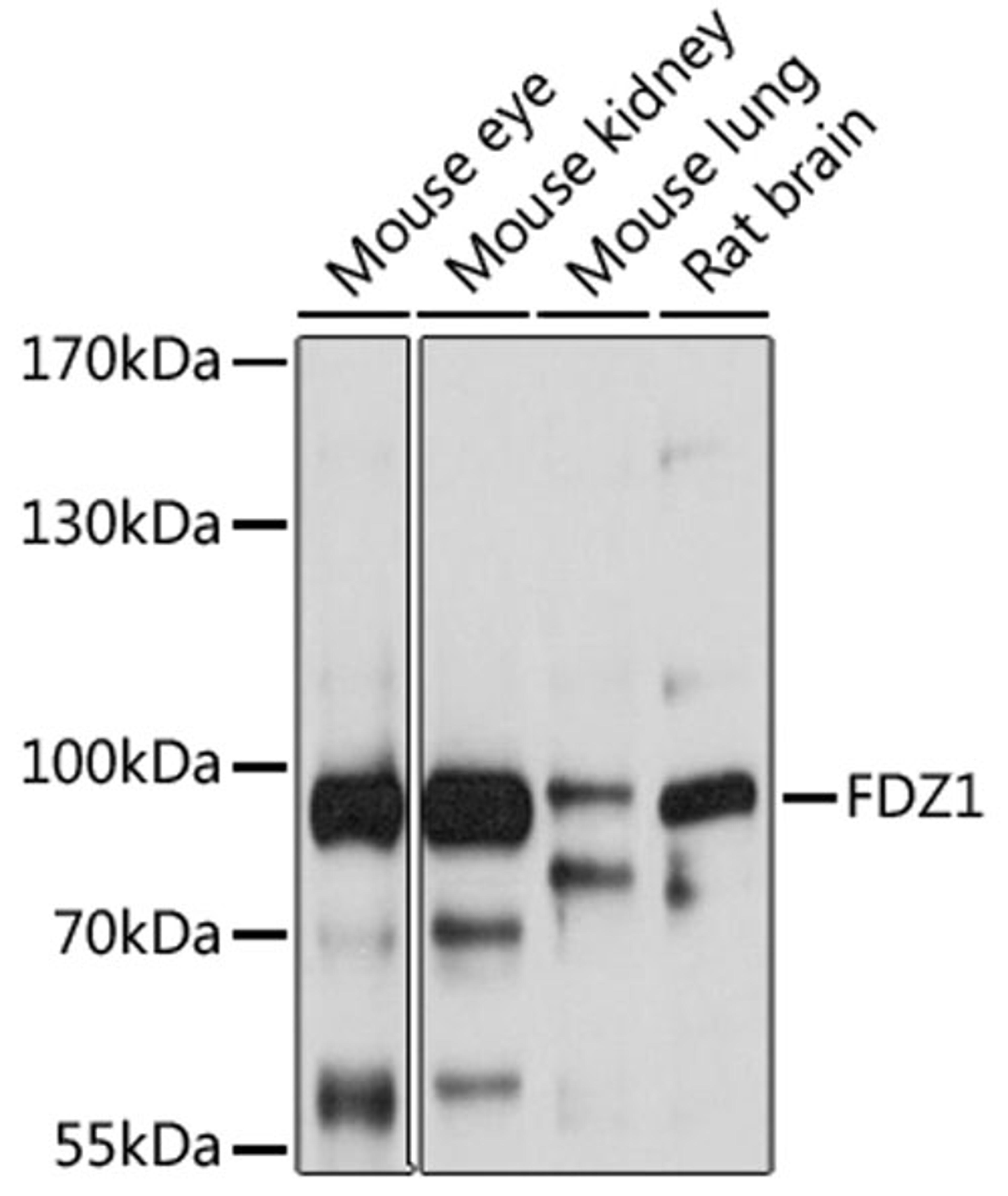 Western blot - FZD1 antibody (A10809)