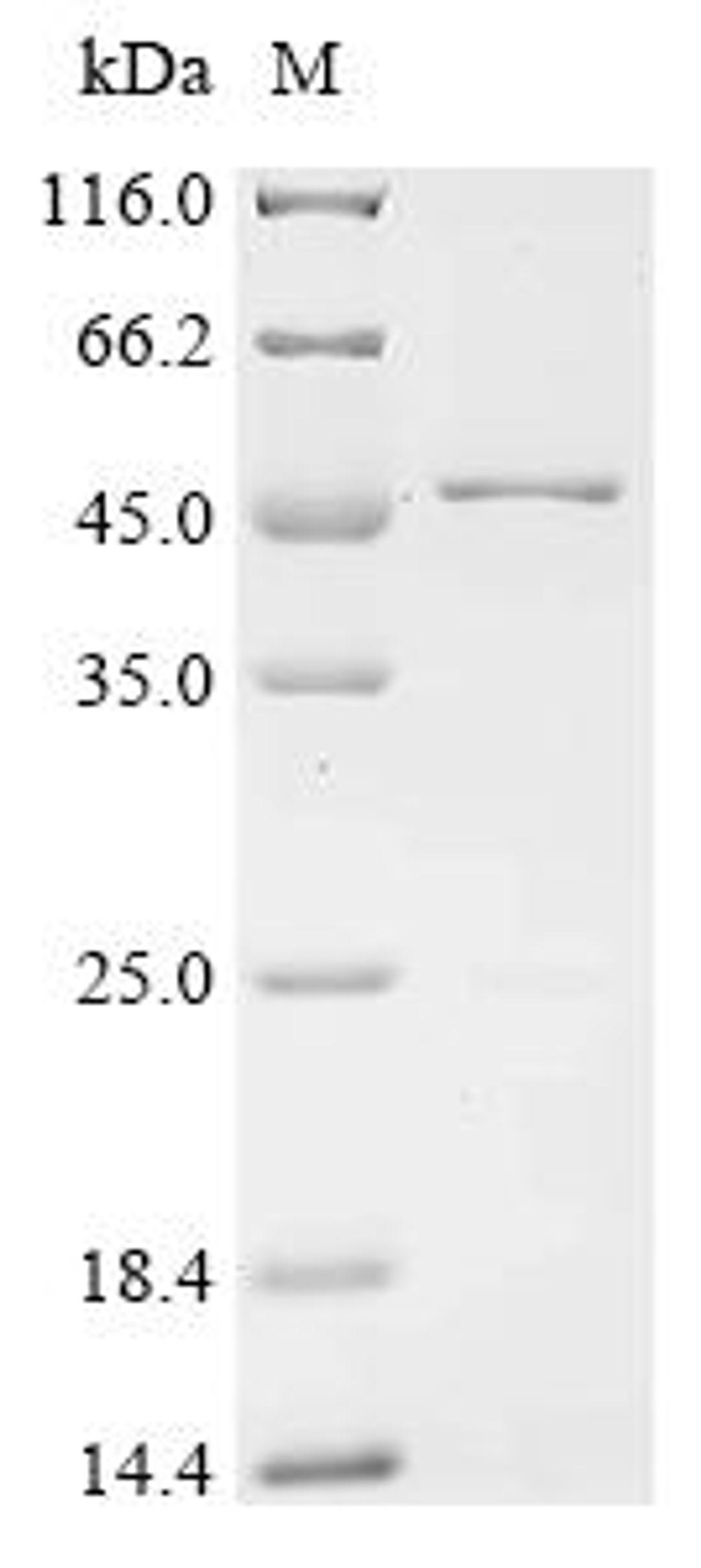 (Tris-Glycine gel) Discontinuous SDS-PAGE (reduced) with 5% enrichment gel and 15% separation gel.