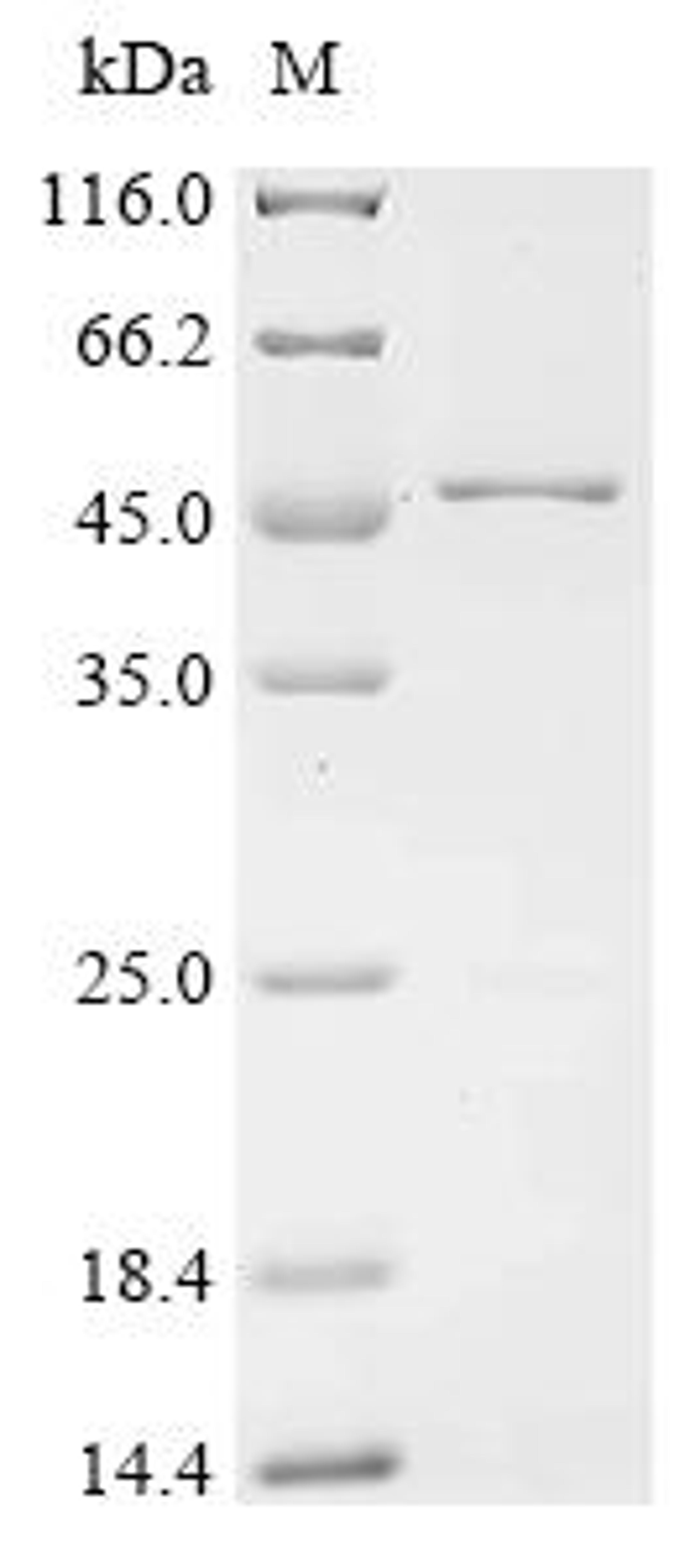 (Tris-Glycine gel) Discontinuous SDS-PAGE (reduced) with 5% enrichment gel and 15% separation gel.