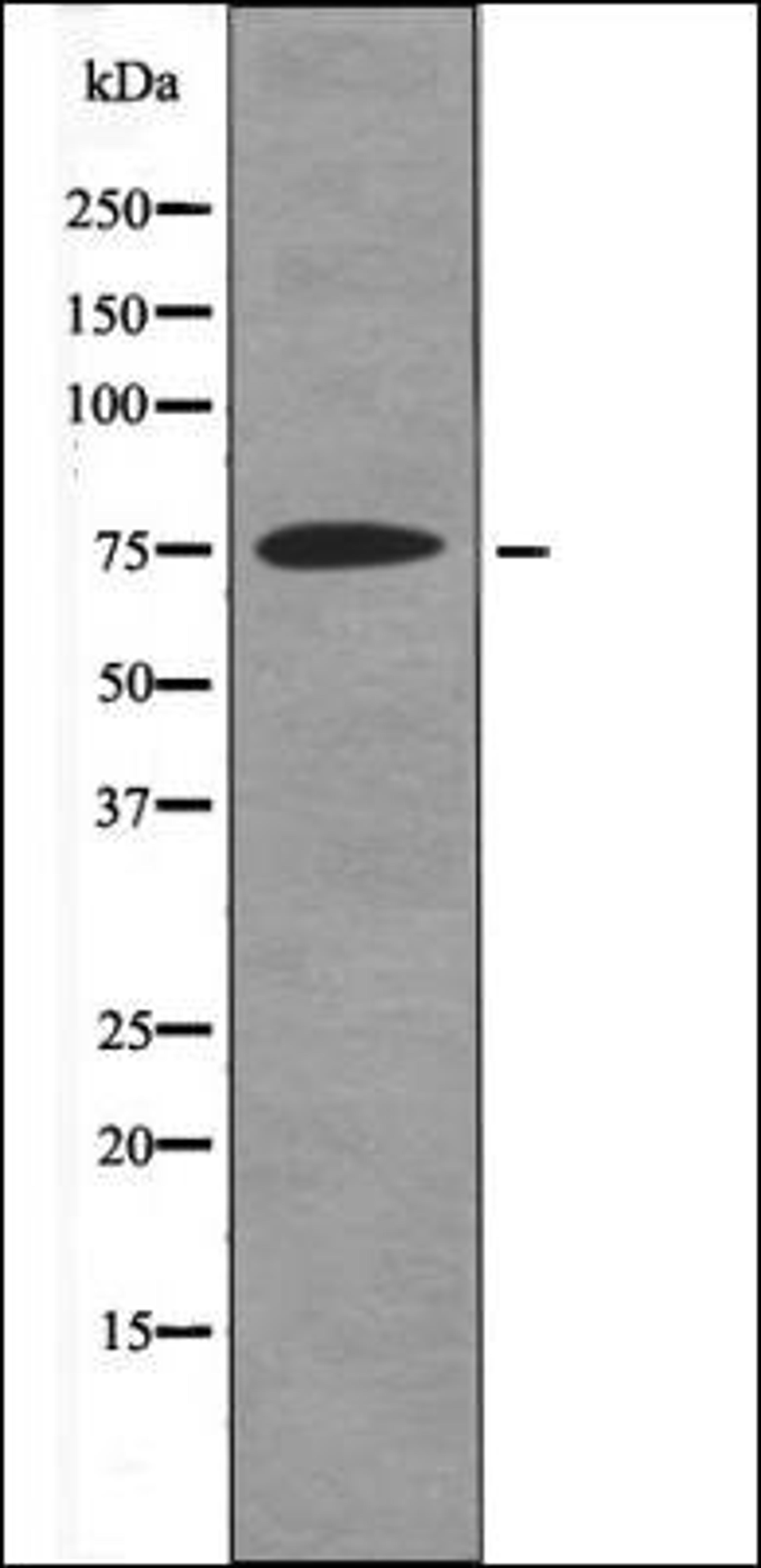 Western blot analysis of HeLa whole cell lysates using GRB2 -Phospho-Tyr614- antibody