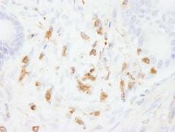 Detection of human Coronin 1 by immunohistochemistry.