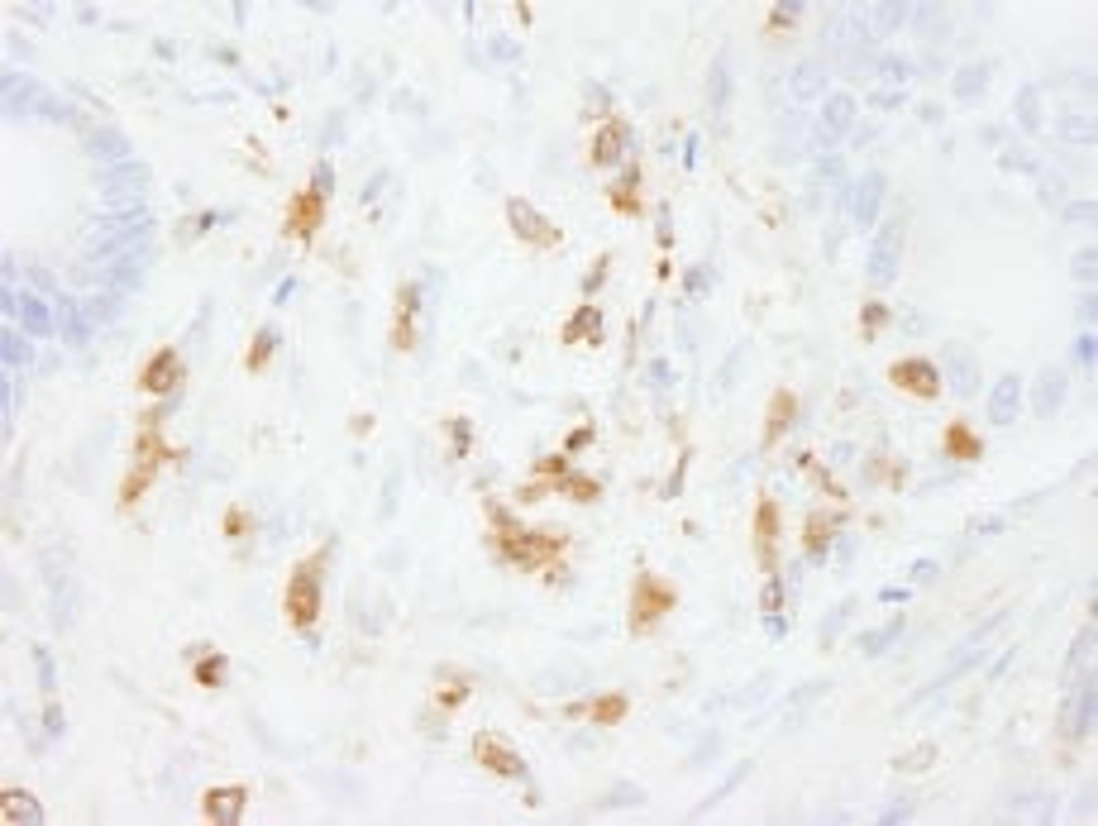 Detection of human Coronin 1 by immunohistochemistry.