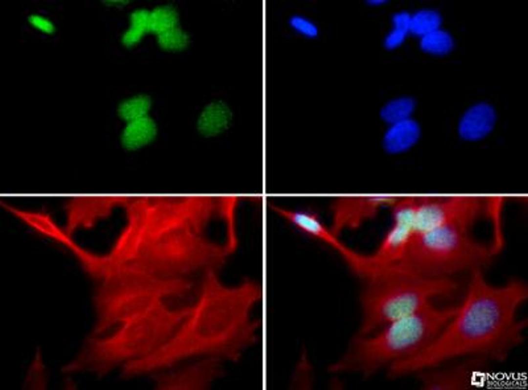 Immunocytochemistry/Immunofluorescence: UBCH6 Antibody [NBP1-78983] - UBCH6 antibody was tested in HeLa cells with FITC (green). Nuclei and alpha-tubulin were counterstained with DAPI (blue) and Dylight 550 (red).