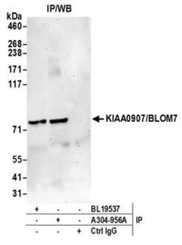 Detection of human KIAA0907/BLOM7 by western blot of immunoprecipitates.