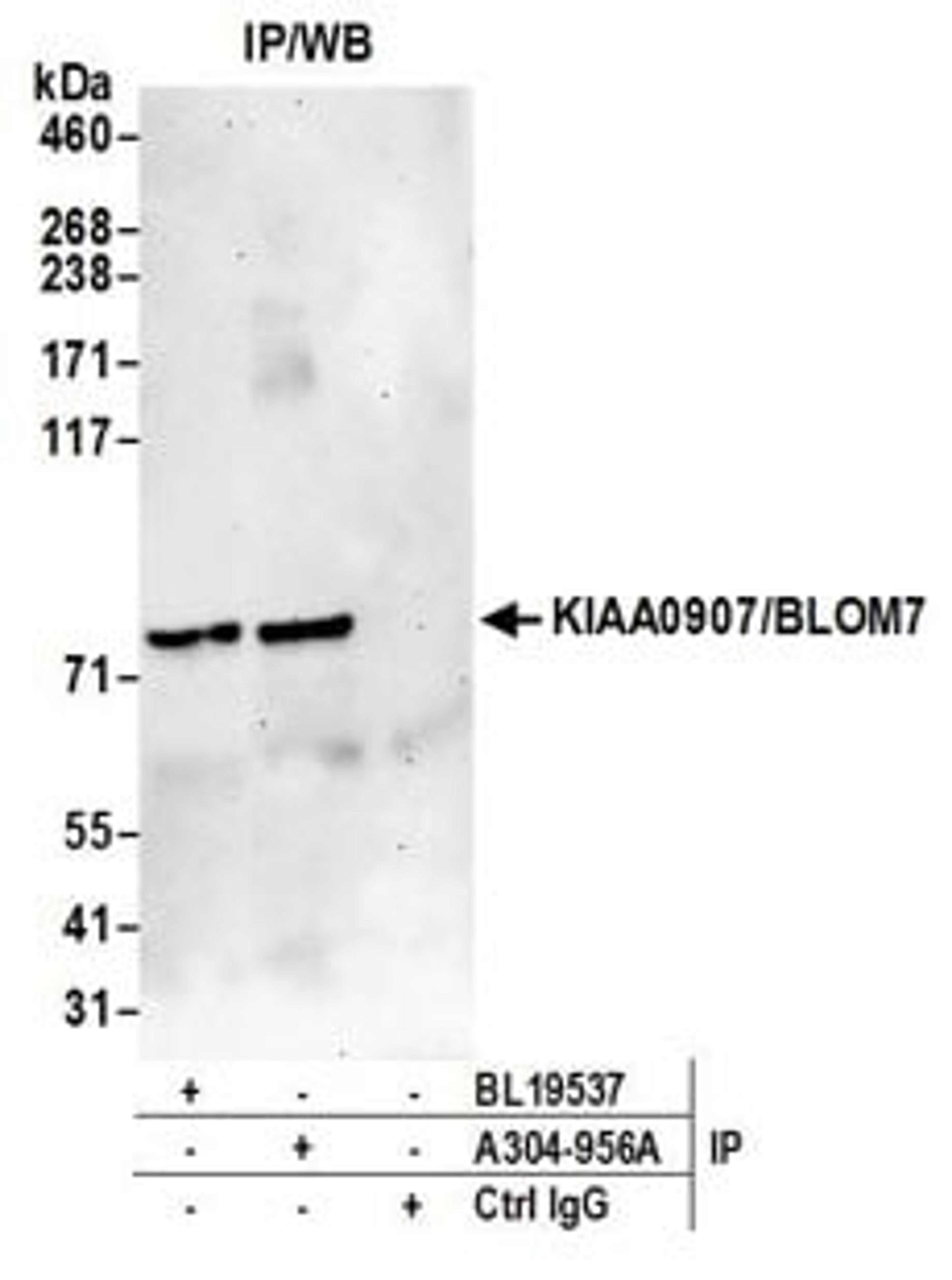 Detection of human KIAA0907/BLOM7 by western blot of immunoprecipitates.