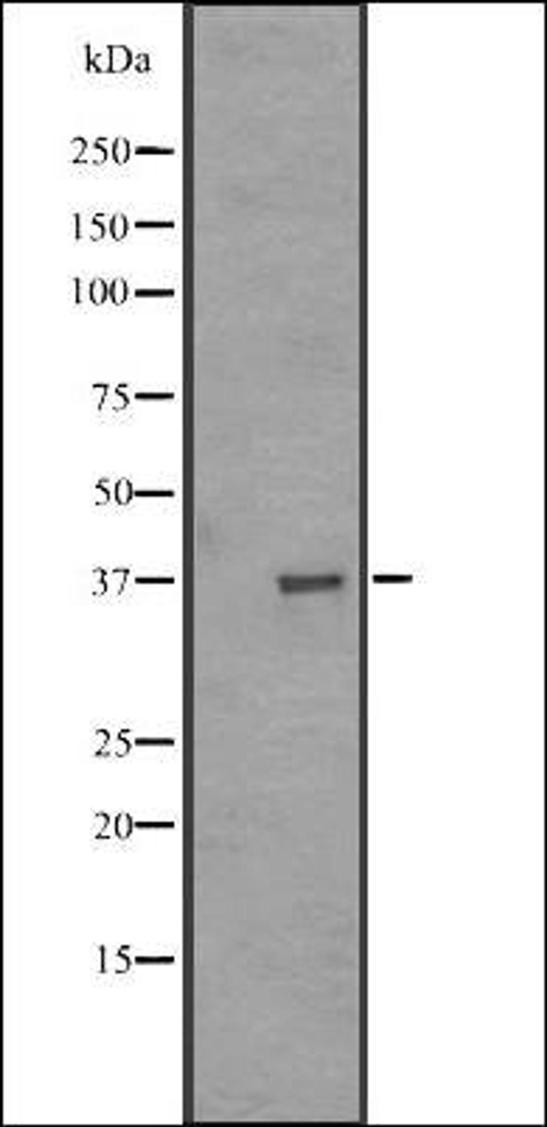 Western blot analysis of MDA-MB453 cell line lysate using OR51A1P antibody