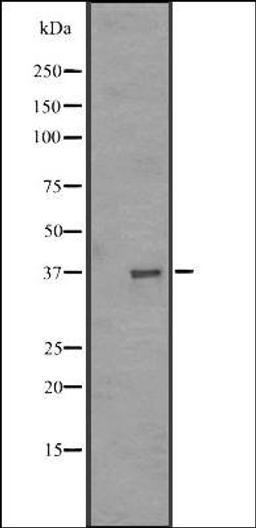 Western blot analysis of MDA-MB453 cell line lysate using OR51A1P antibody