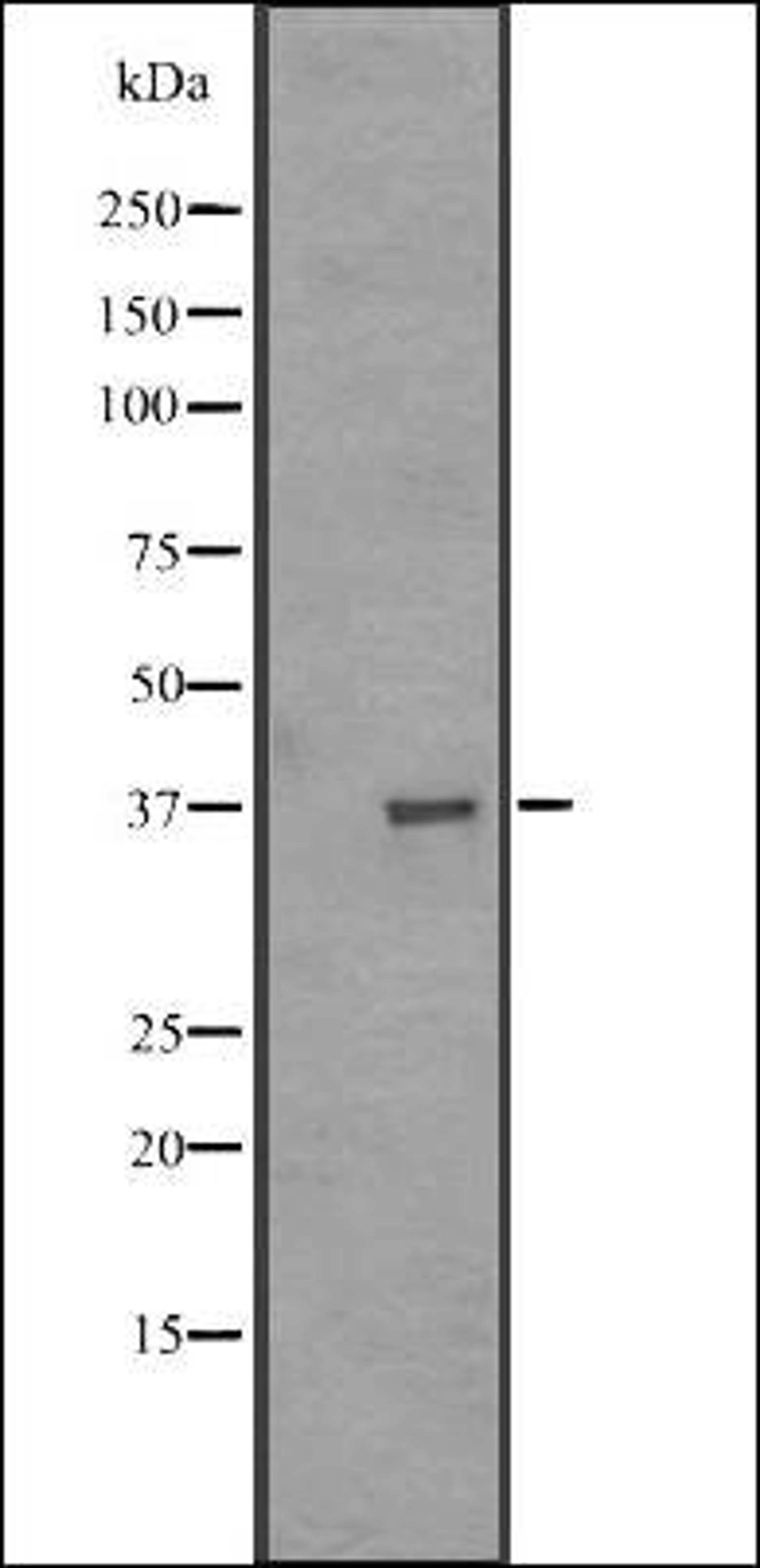 Western blot analysis of MDA-MB453 cell line lysate using OR51A1P antibody