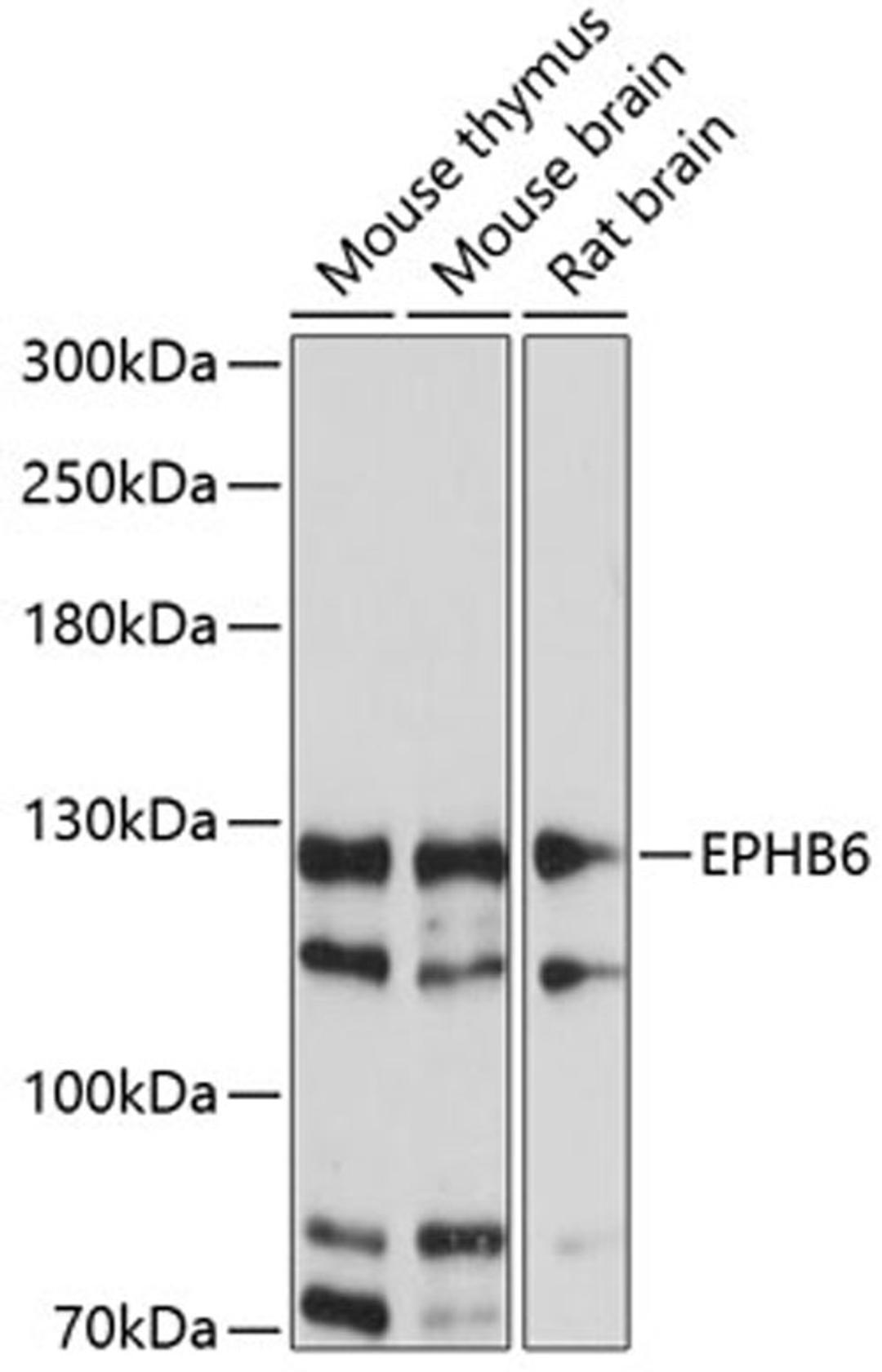 Western blot - EPHB6 antibody (A14729)