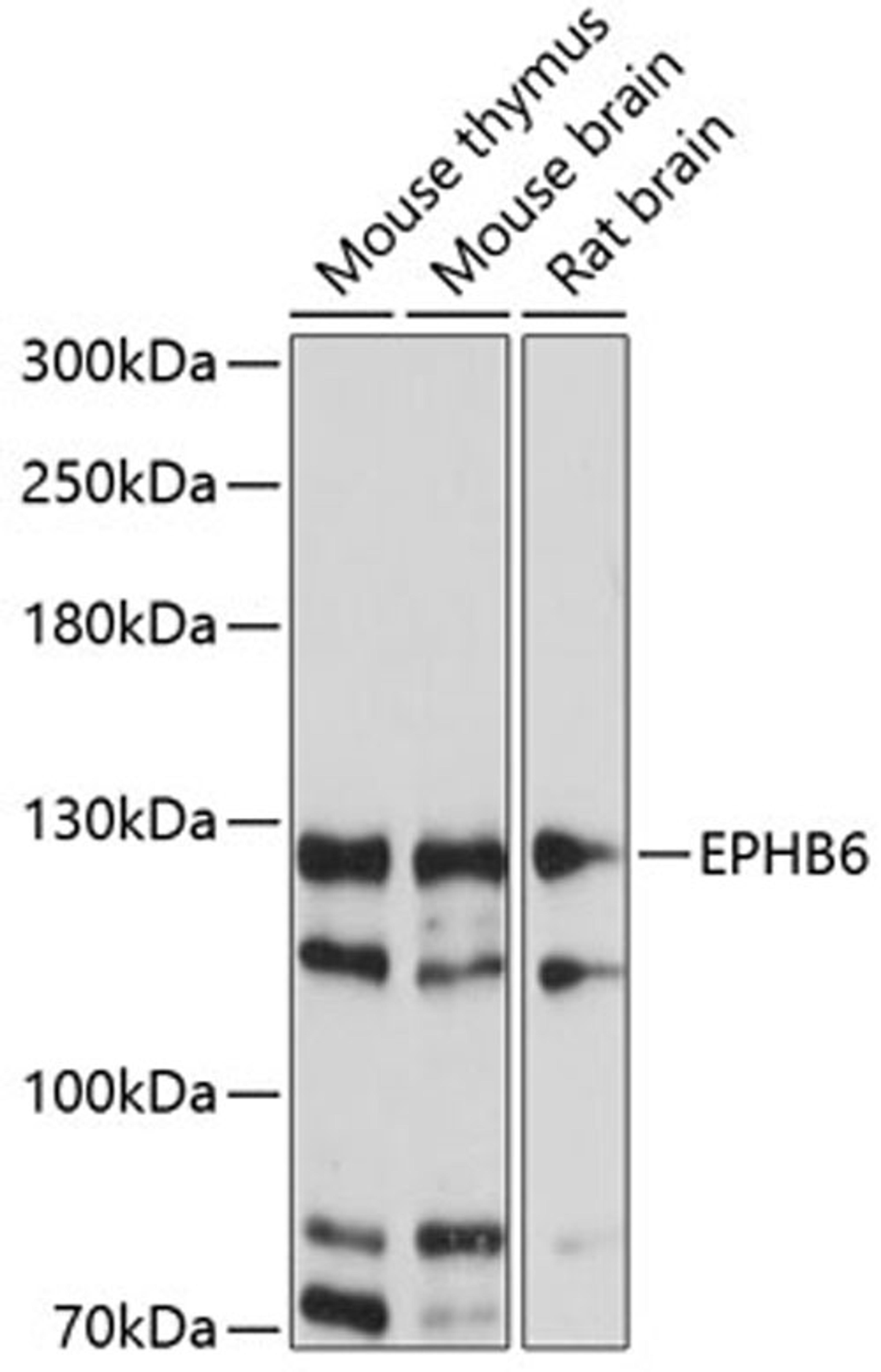 Western blot - EPHB6 antibody (A14729)