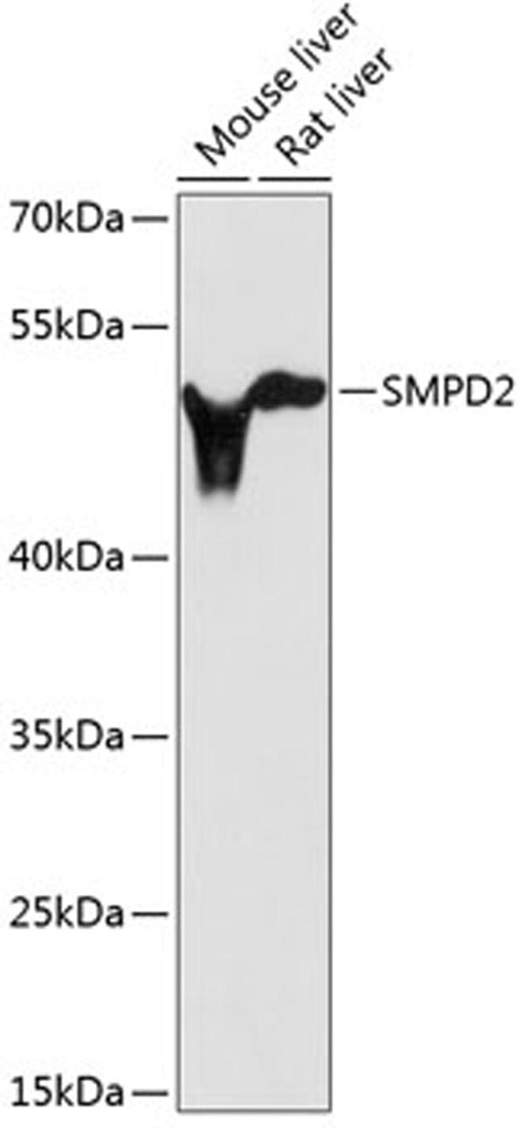 Western blot - SMPD2 antibody (A1166)