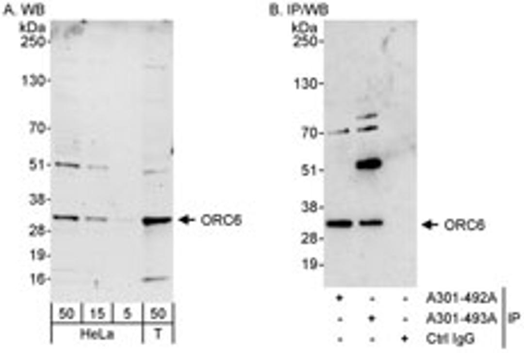 Detection of human ORC6 by western blot and immunoprecipitation.