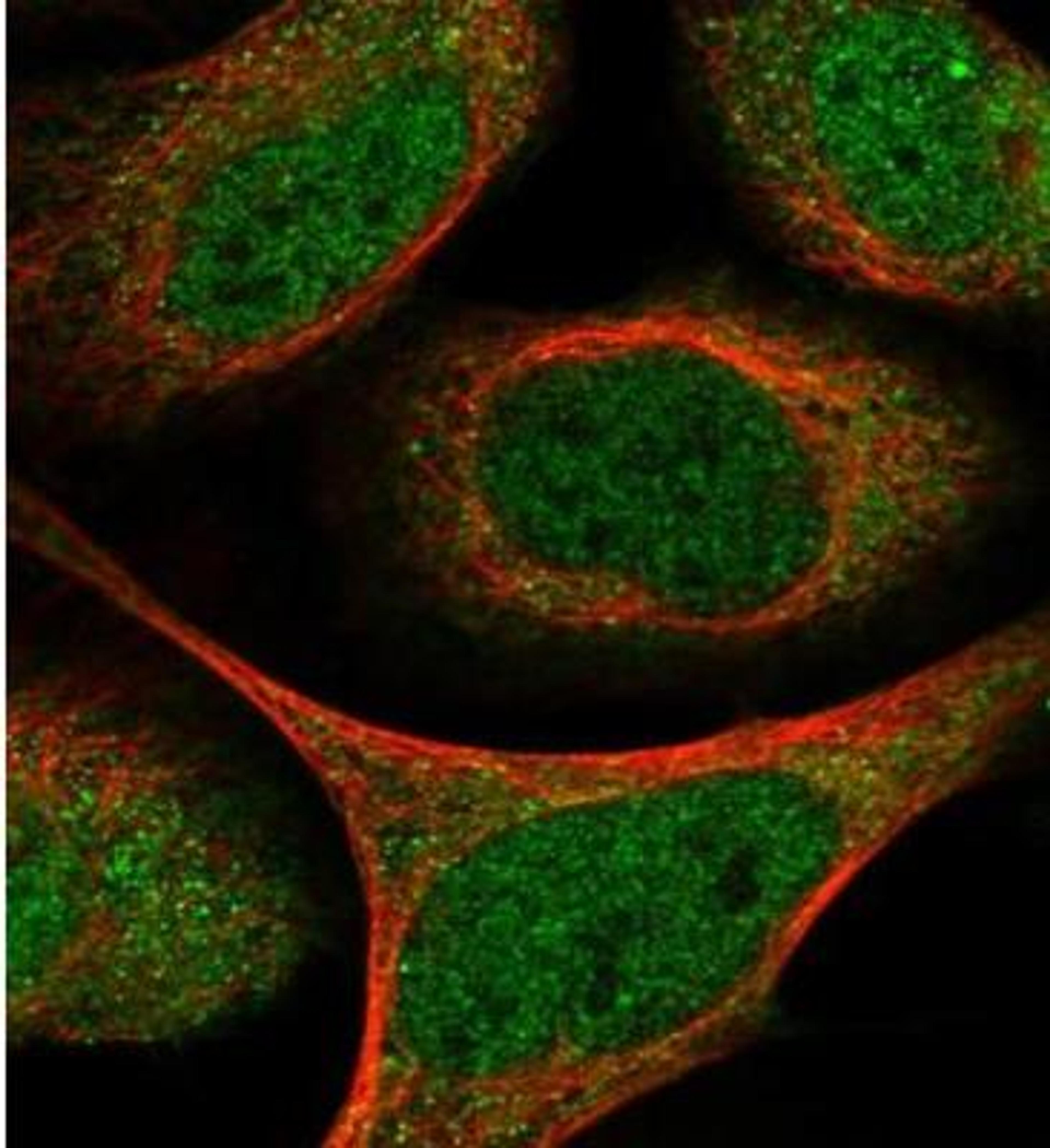 Immunocytochemistry/Immunofluorescence: CLEC16A Antibody [NBP1-81805] - Staining of human cell line U-2 OS shows positivity in cytoplasm & nucleus but excluded from the nucleoli