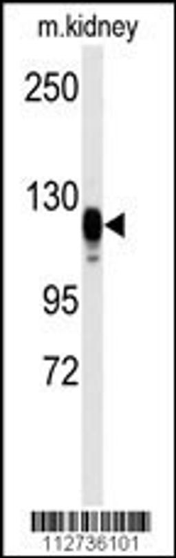 Western blot analysis of anti-EGFR Antibody (S1070) in kidney heart tissue lysates (35ug/lane)