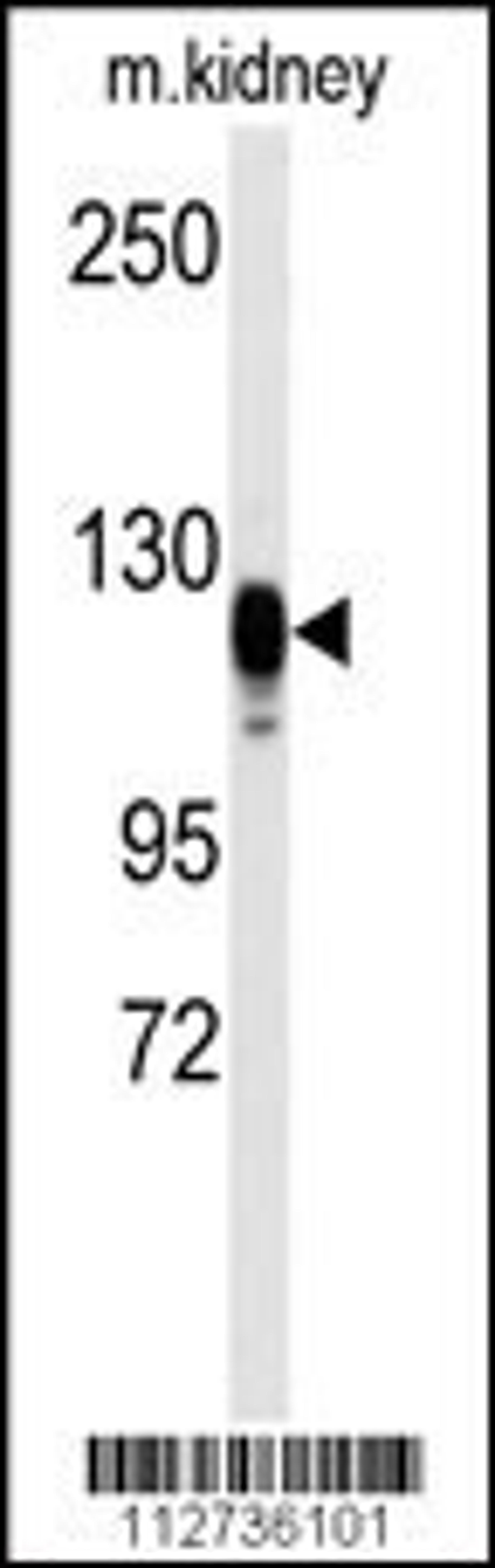 Western blot analysis of anti-EGFR Antibody (S1070) in kidney heart tissue lysates (35ug/lane)