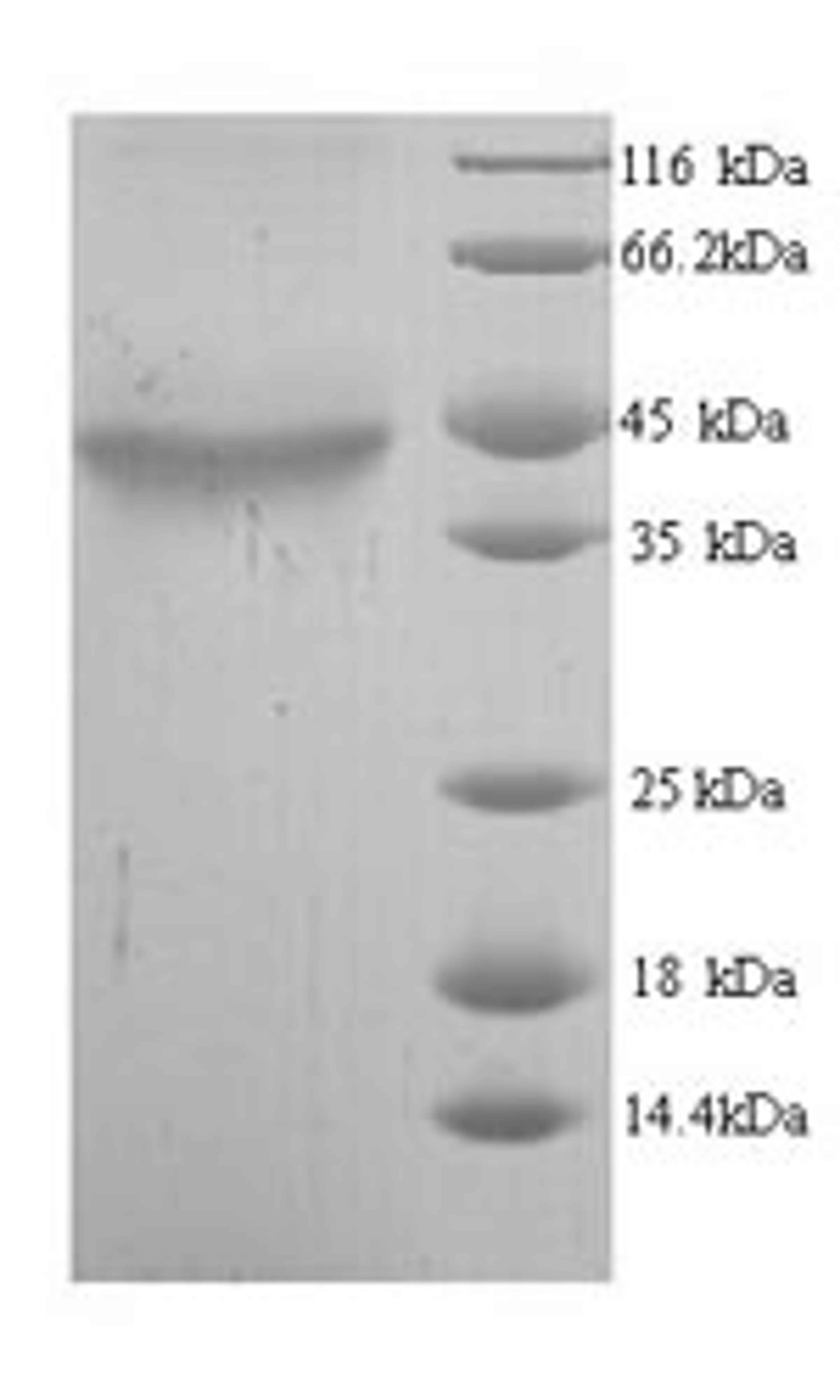 (Tris-Glycine gel) Discontinuous SDS-PAGE (reduced) with 5% enrichment gel and 15% separation gel.