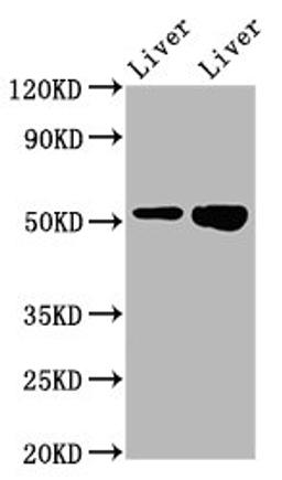 Western Blot. Positive WB detected in: Rat liver tissue, Mouse liver tissue. All lanes: PRSS16 antibody at 3.2ug/ml. Secondary. Goat polyclonal to rabbit IgG at 1/50000 dilution. Predicted band size: 56 kDa. Observed band size: 56 kDa.