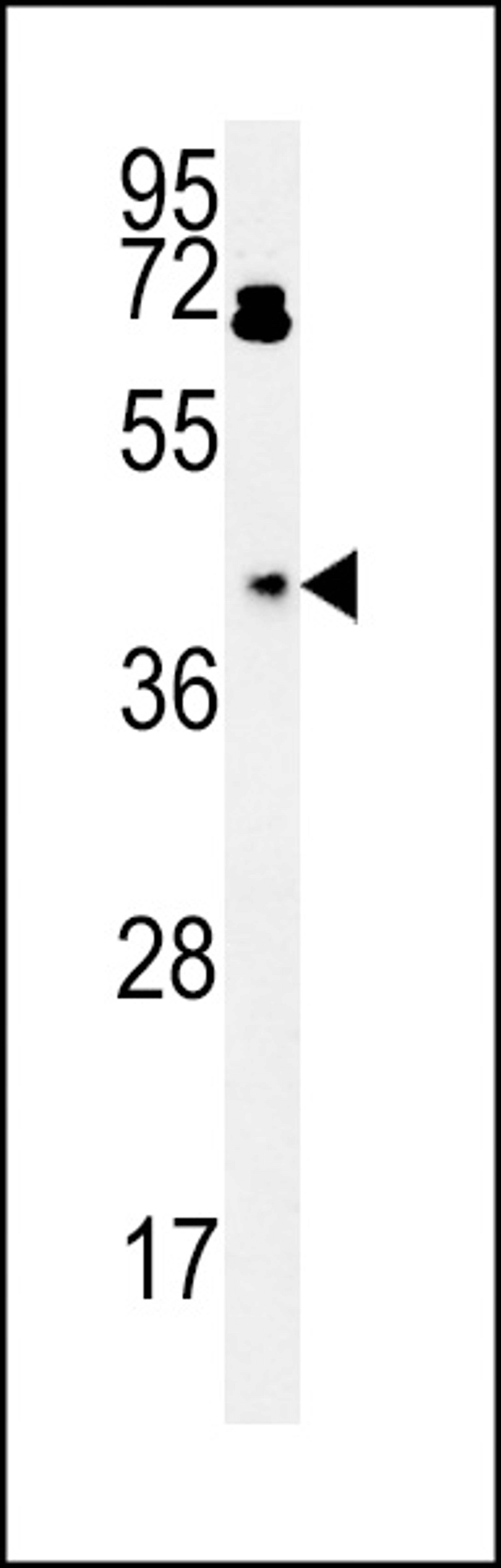 Western blot analysis in HepG2 cell line lysates (15ug/lane).