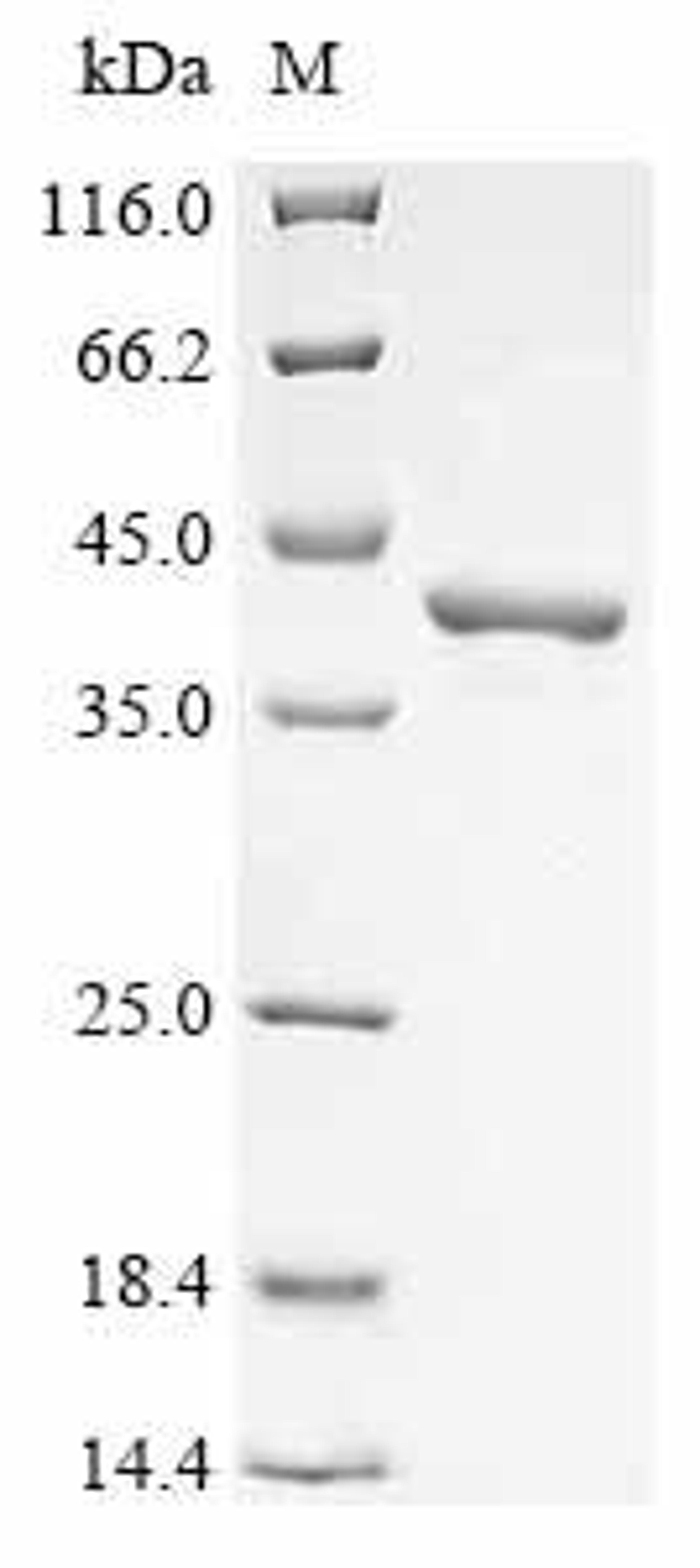 (Tris-Glycine gel) Discontinuous SDS-PAGE (reduced) with 5% enrichment gel and 15% separation gel.