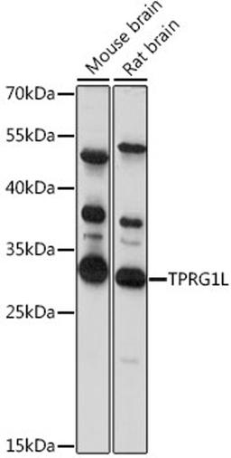 Western blot - TPRG1L antibody (A15949)