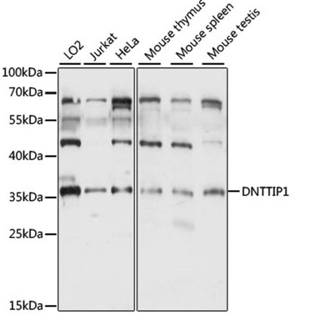 Western blot - DNTTIP1 antibody (A15558)