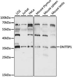 Western blot - DNTTIP1 antibody (A15558)