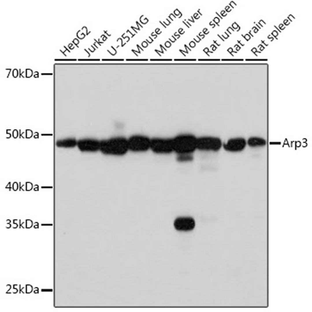 Western blot - Arp3 Rabbit mAb (A4514)