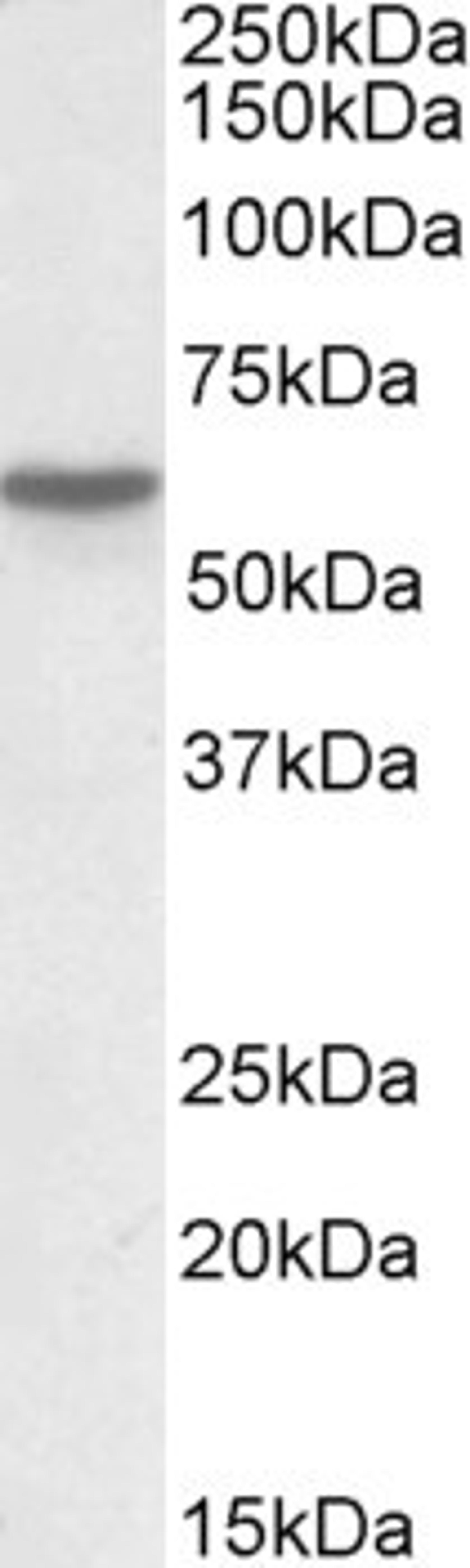 Western Blot: Vitamin D Binding Protein Antibody [NB100-94908] - (0.03ug/ml) staining of Lung lysate (35ug protein in RIPA buffer). Primary incubation was 1 hour. Detected by chemiluminescence.