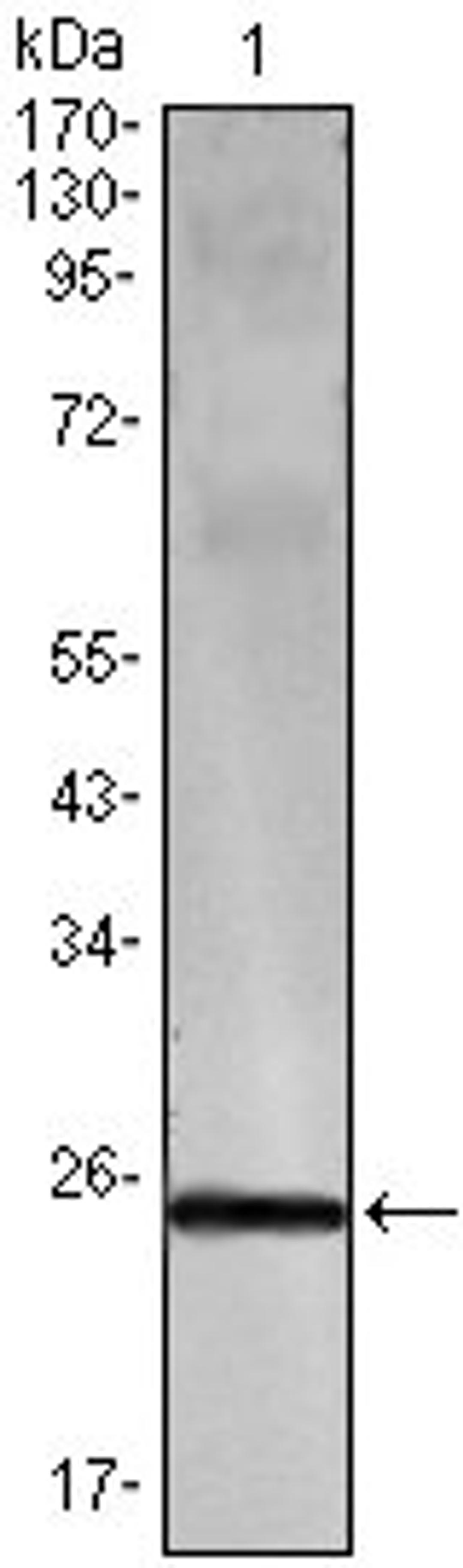 Western blot analysis of recombinant protein using IFN-gamma antibody