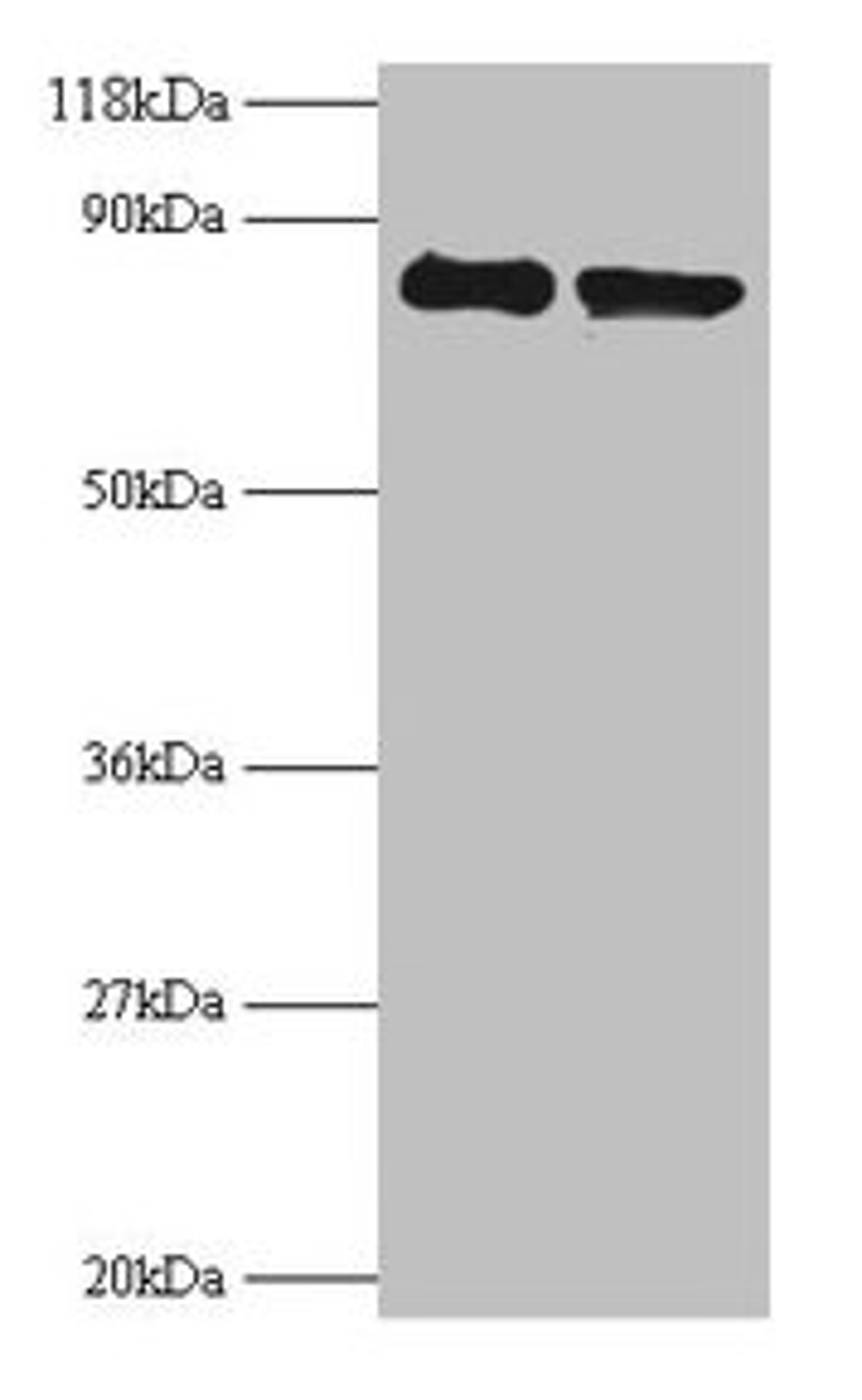 Western blot. All lanes: RPS10 antibody at 2µg/ml. Lane 1: EC109 whole cell lysate. Lane 2: 293T whole cell lysate. Secondary. Goat polyclonal to rabbit IgG at 1/15000 dilution. Predicted band size: 19 kDa. Observed band size: 80 kDa