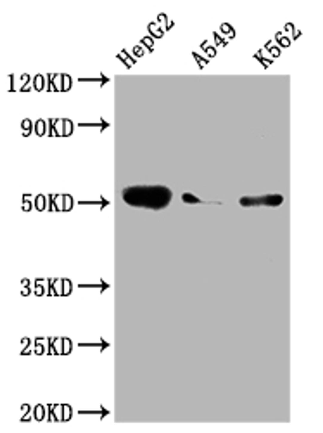 Western Blot. Positive WB detected in: HepG2 whole cell lysate, A549 whole cell lysate, K562 whole cell lysate. All lanes: Factor IX antibody at 1:2000. Secondary. Goat polyclonal to rabbit IgG at 1/50000 dilution. Predicted band size: 52 kDa. Observed band size: 52 kDa.