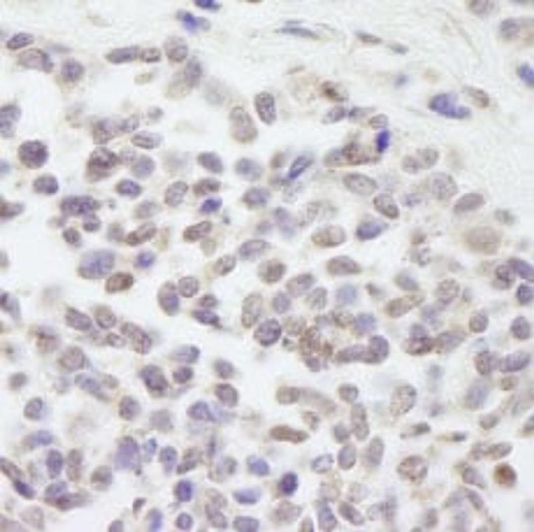 Detection of human Cul3 by immunohistochemistry.