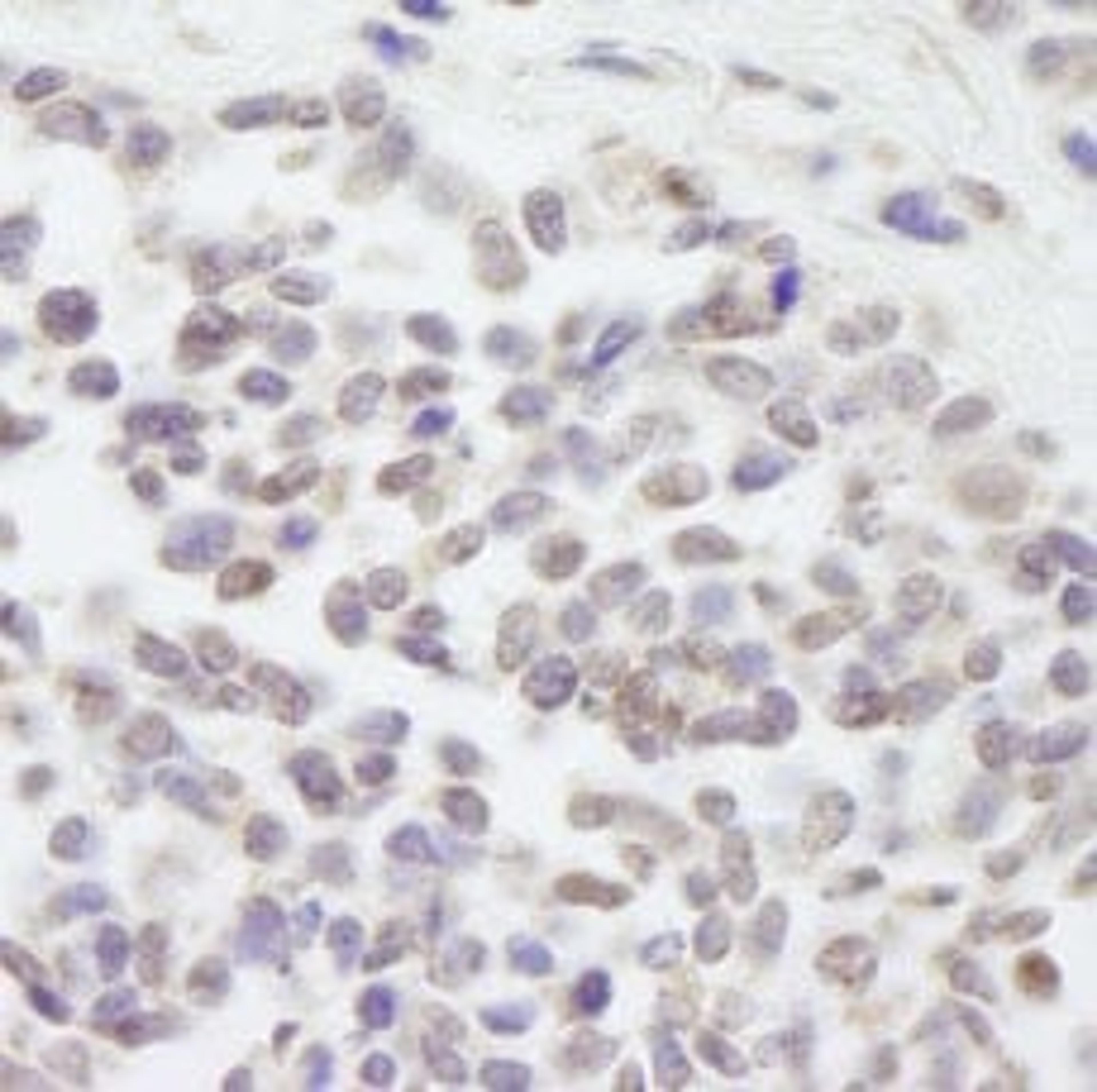 Detection of human Cul3 by immunohistochemistry.