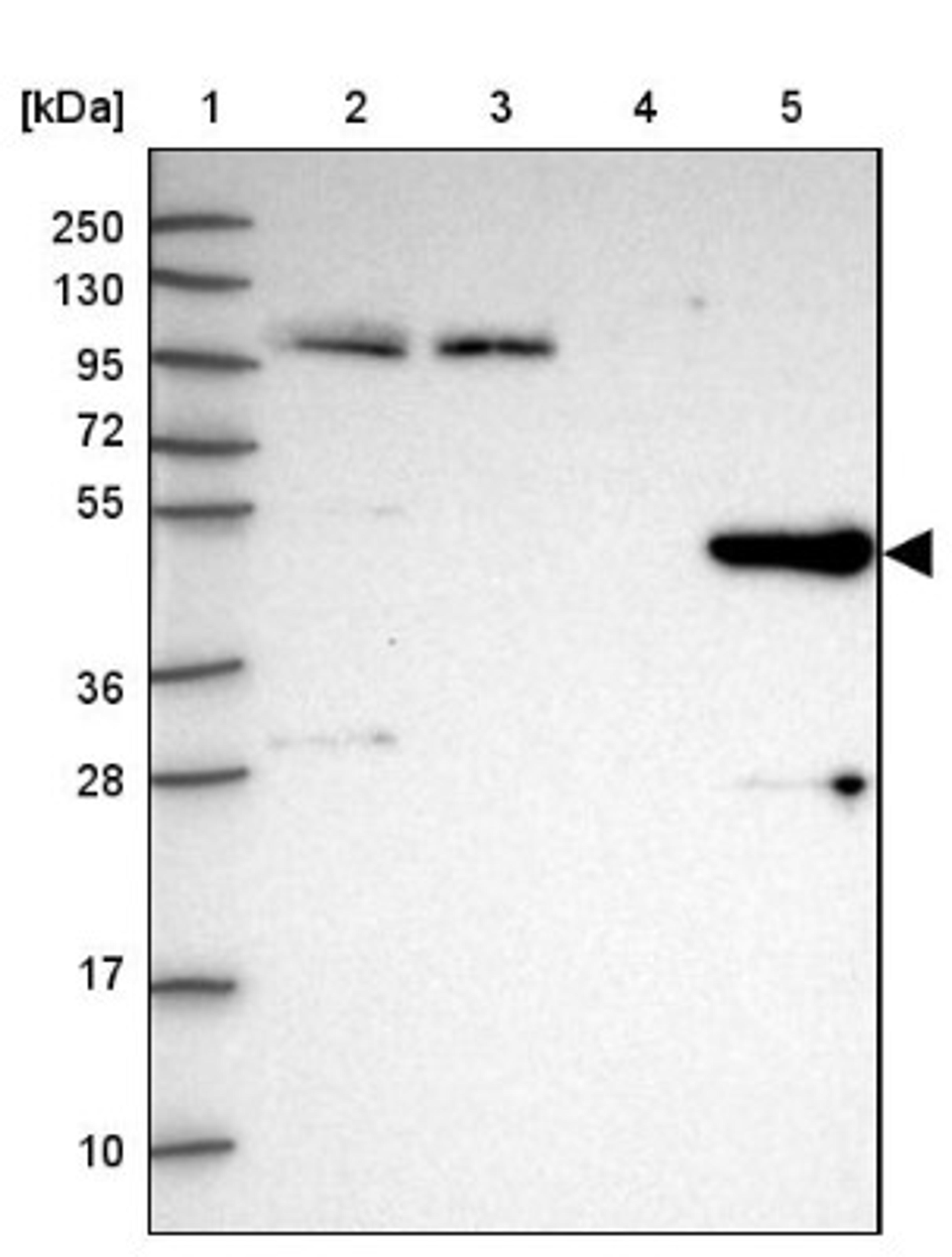 Western Blot: HGD Antibody [NBP2-33488] - Lane 1: Marker [kDa] 250, 130, 95, 72, 55, 36, 28, 17, 10<br/>Lane 2: Human cell line RT-4<br/>Lane 3: Human cell line U-251MG sp<br/>Lane 4: Human plasma (IgG/HSA depleted)<br/>Lane 5: Human liver tissue