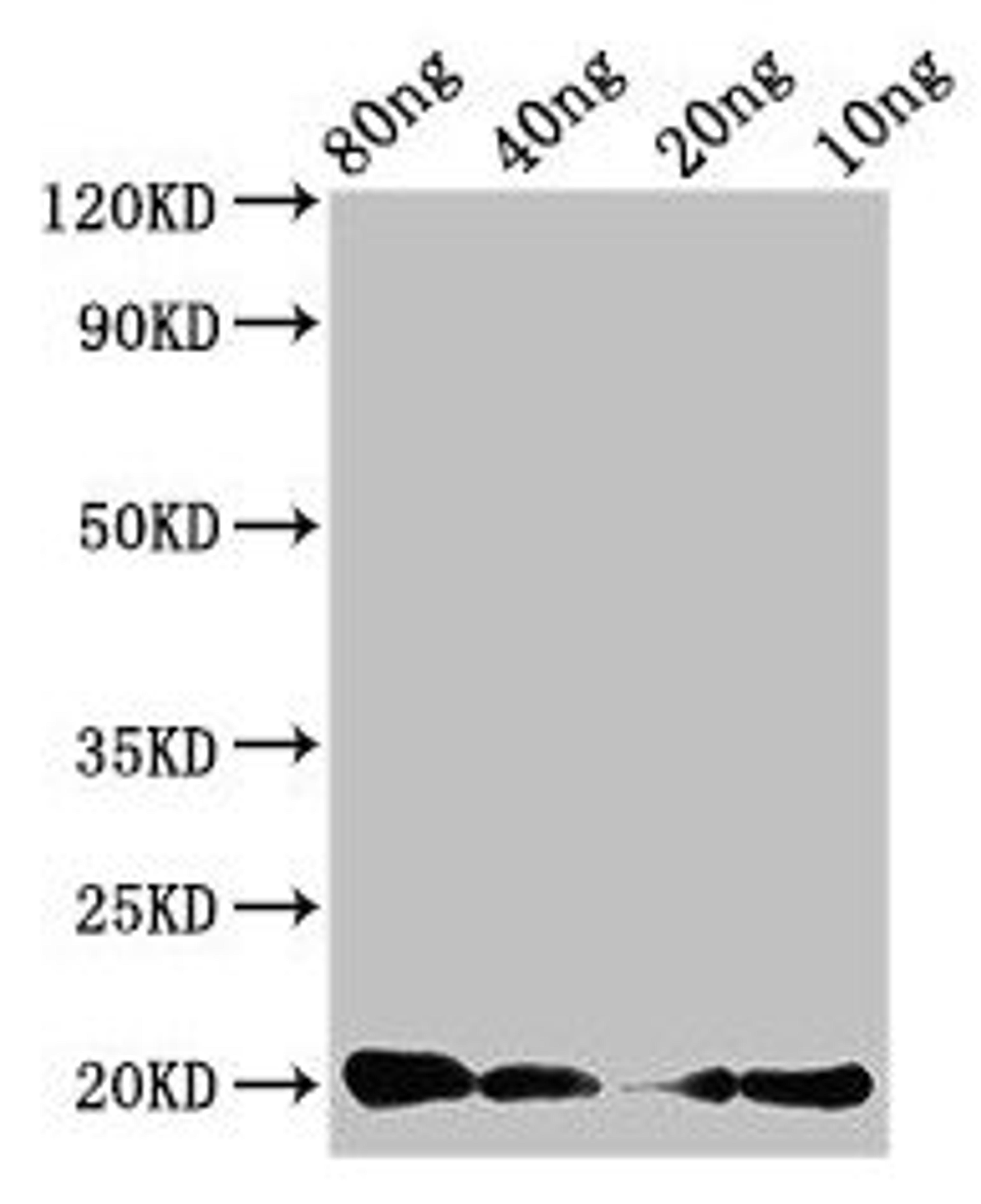 Western Blot. Positive WB detected in Recombinant protein. All lanes: CALCA antibody at 3µg/ml. Secondary. Goat polyclonal to rabbit IgG at 1/50000 dilution. Predicted band size: 20 kDa. Observed band size: 20 kDa