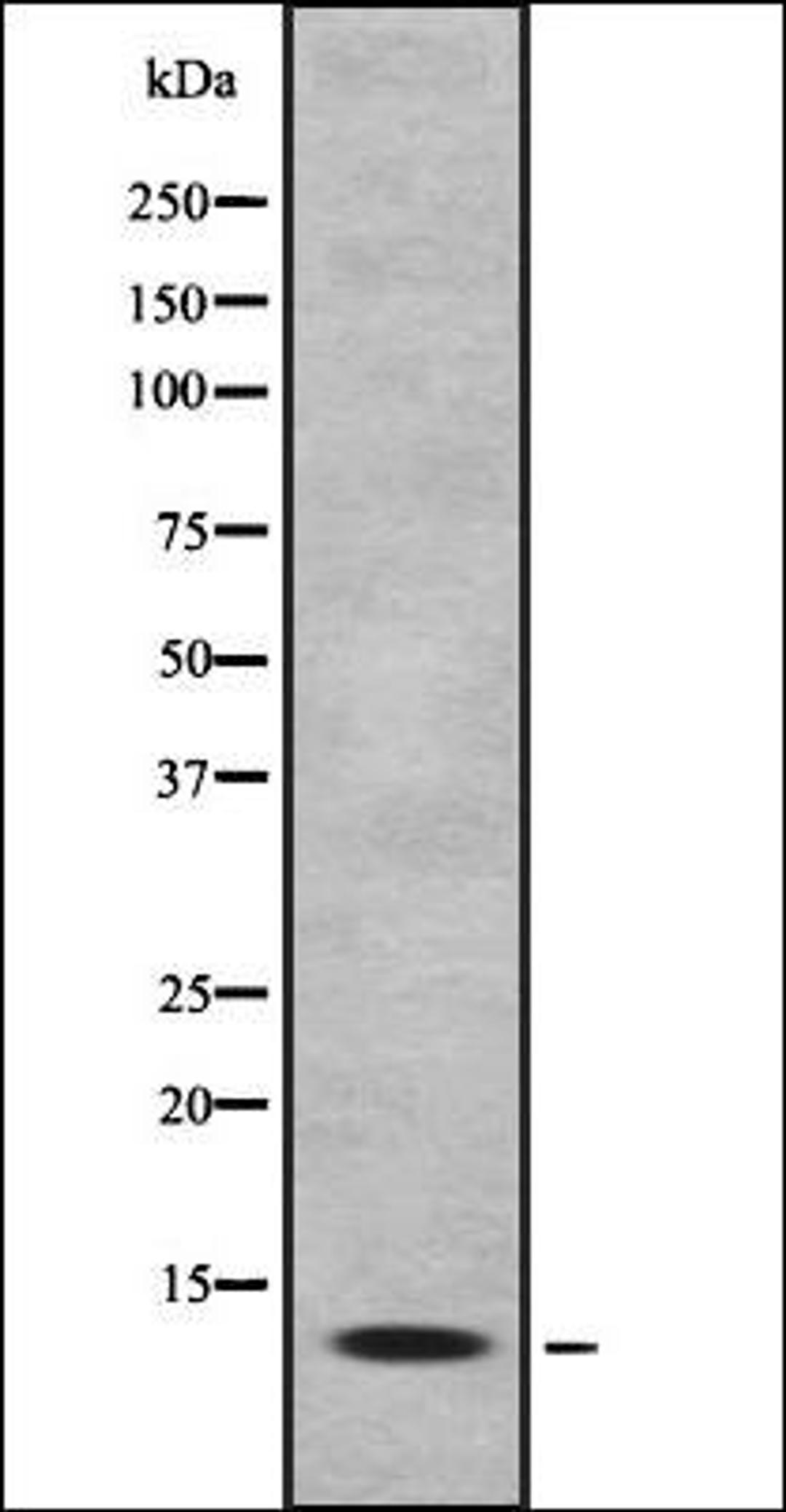 Western blot analysis of HEK293 cells using MK1I1 antibody