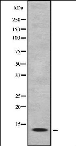 Western blot analysis of HEK293 cells using MK1I1 antibody