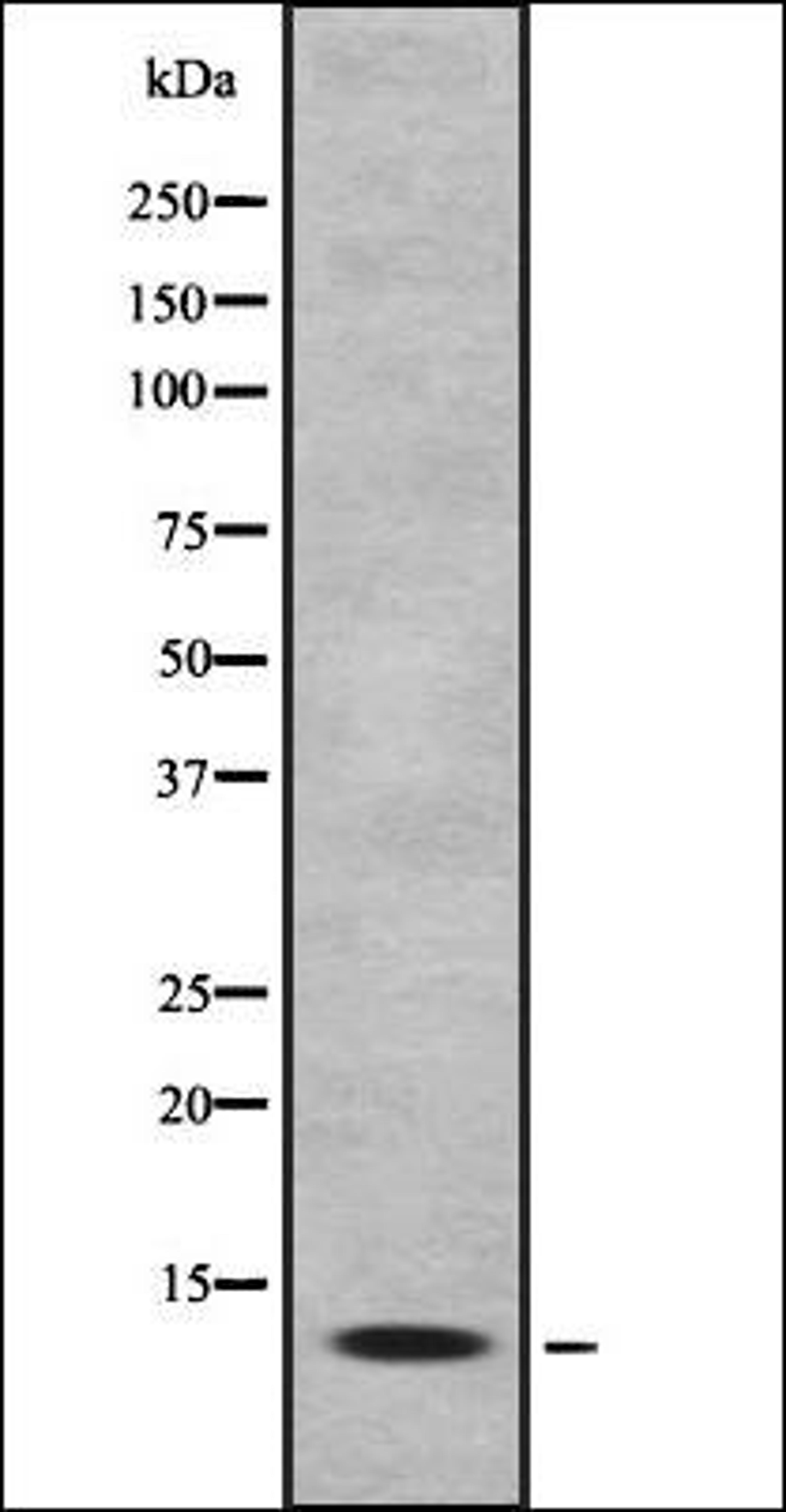 Western blot analysis of HEK293 cells using MK1I1 antibody