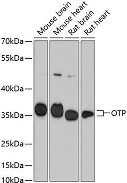 Western blot - OTP antibody (A13188)