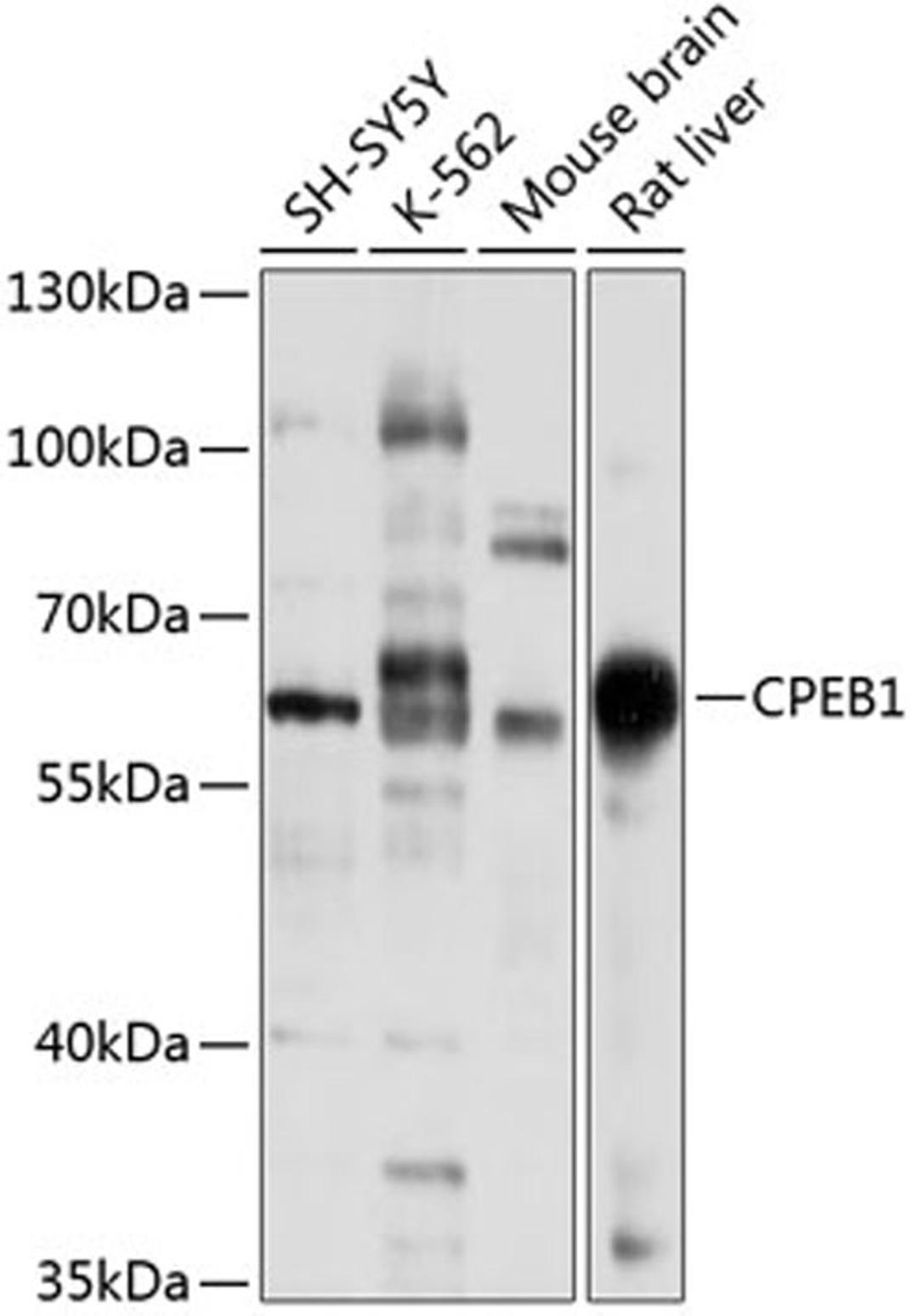 Western blot - CPEB1 antibody (A5913)