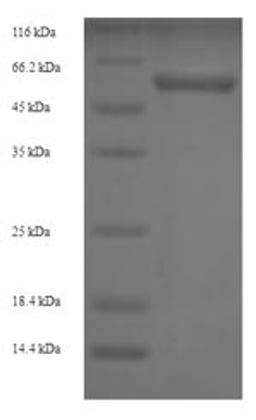 (Tris-Glycine gel) Discontinuous SDS-PAGE (reduced) with 5% enrichment gel and 15% separation gel.