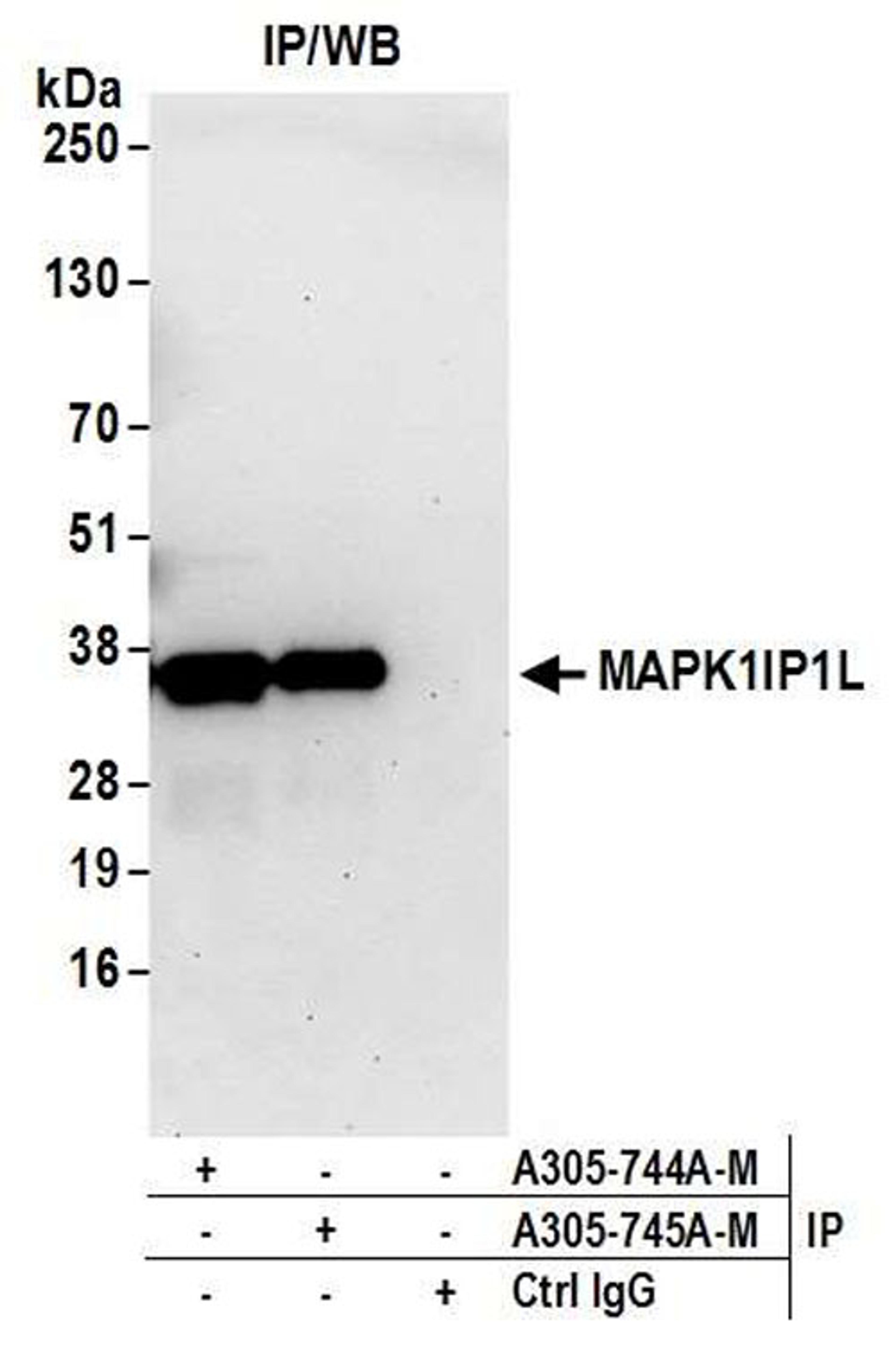 Detection of human MAPK1IP1L by WB of IP.