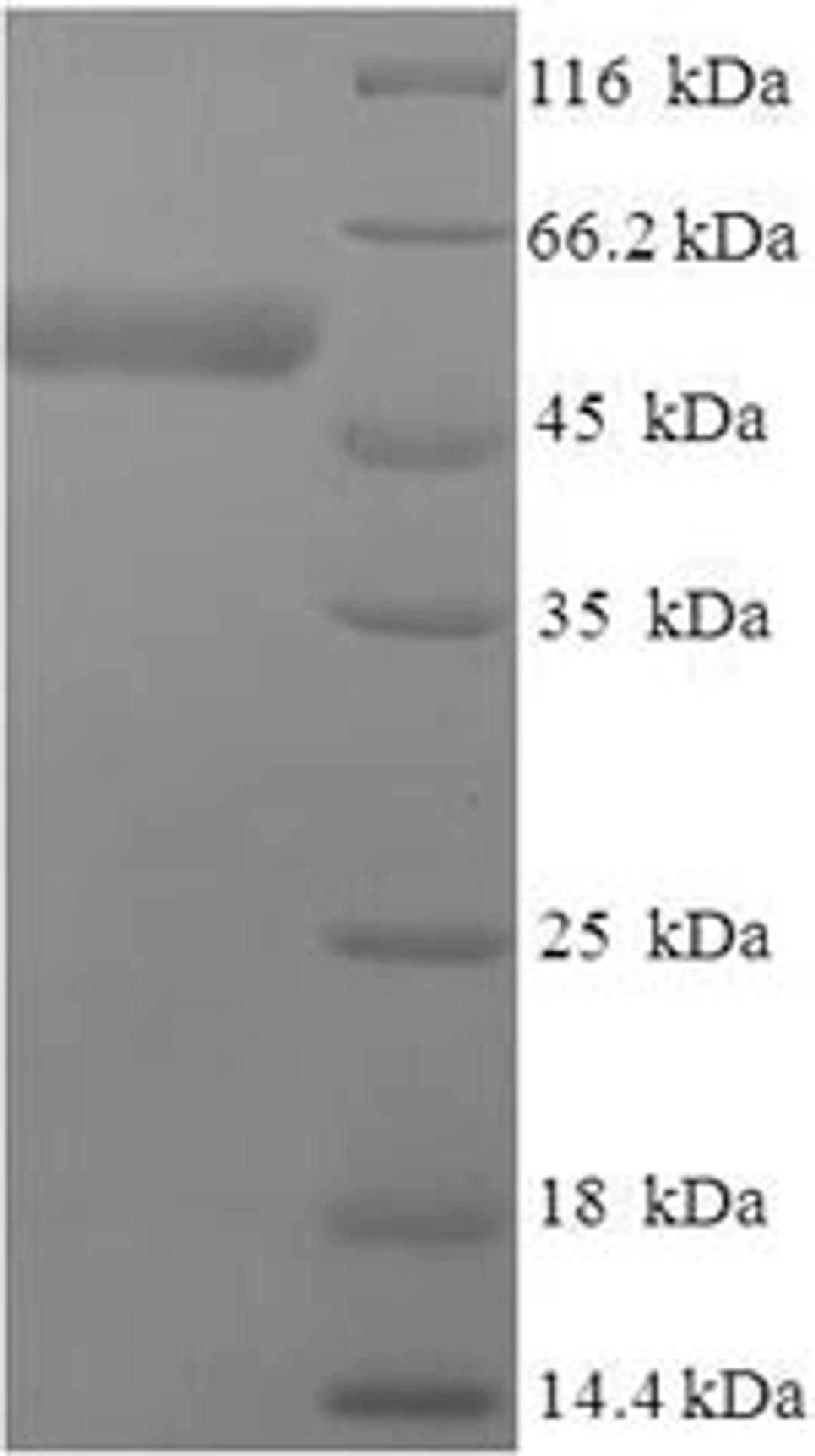 (Tris-Glycine gel) Discontinuous SDS-PAGE (reduced) with 5% enrichment gel and 15% separation gel.