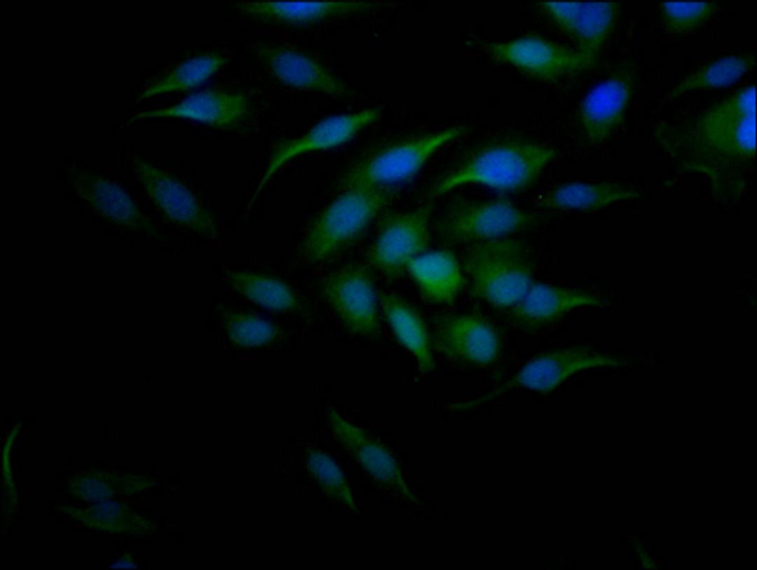 Immunofluorescence staining of Hela Cells with CSB-RA204558A0HU at 1:50, counter-stained with DAPI. The cells were fixed in 4% formaldehyde, permeated by 0.2% TritonX-100, and blocked in 10% normal Goat Serum. The cells were then incubated with the antibody overnight at 4℃. Nuclear DNA was labeled in blue with DAPI. The secondary antibody was FITC-conjugated AffiniPure Goat Anti-Rabbit IgG (H+L).