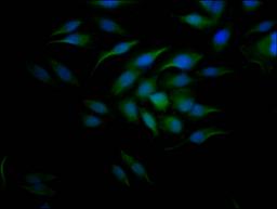 Immunofluorescence staining of Hela Cells with CSB-RA204558A0HU at 1:50, counter-stained with DAPI. The cells were fixed in 4% formaldehyde, permeated by 0.2% TritonX-100, and blocked in 10% normal Goat Serum. The cells were then incubated with the antibody overnight at 4℃. Nuclear DNA was labeled in blue with DAPI. The secondary antibody was FITC-conjugated AffiniPure Goat Anti-Rabbit IgG (H+L).
